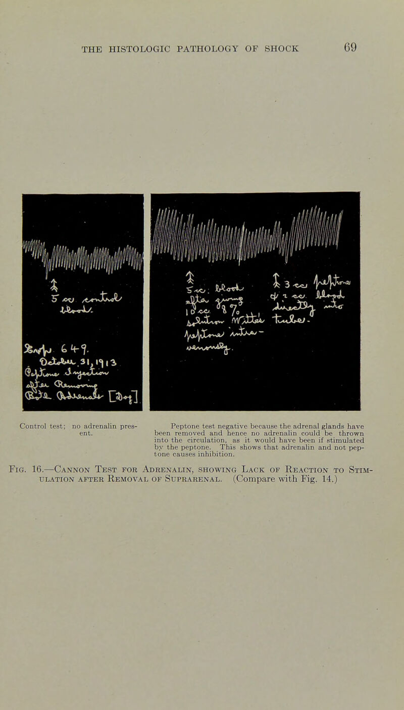 m ^^^SuUnw 'v/>lW XtJU;- Control test; no adrenalin pres- Peptone test negative because the adrenal glands have ent. been removed and hence no adrenalin could be thrown into the circulation, as it would have been if stimulated by the peptone. This shows that adrenalin and not pep- tone causes inhibition. Fig. 16.—Cannon Test for Adrenalin, showing Lack of Reaction to Stim- ulation AFTER Removal of Suprarenal. (Compare with Fig. 14.)