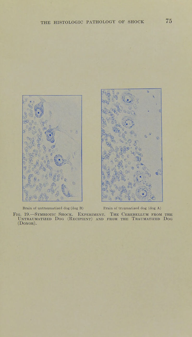 Brain of untraumatized dog (dog B) •>0 4 Brain of traumatized dog (dog A) Fig. 19.—Symbiotic Shock. Experiment. The Cerebellum prom the Untraumatized Dog (Recipient) and from the Traumatized Dog (Donor).