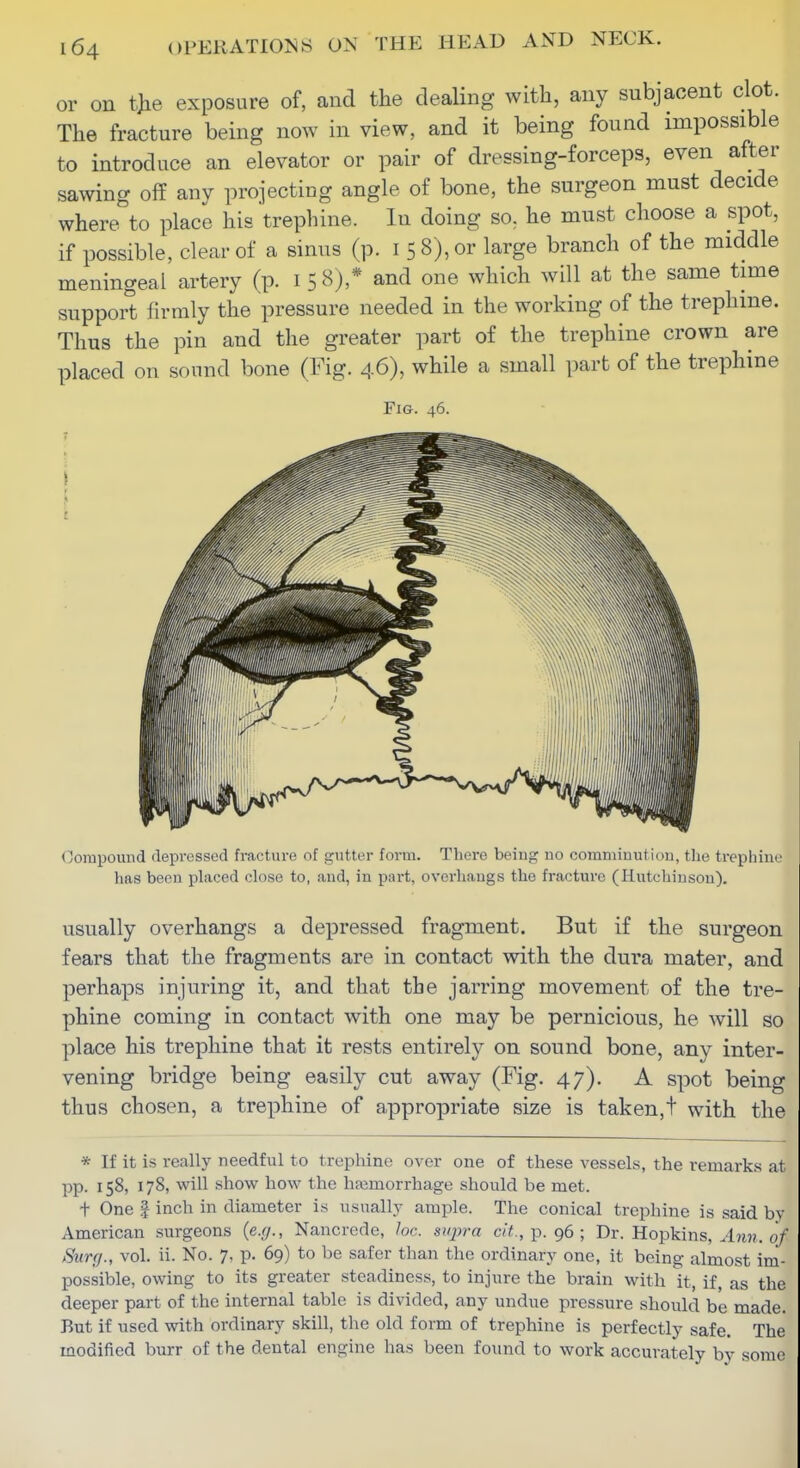 or on the exposure of, and the dealing with, any subjacent clot. The fracture being now in view, and it being found impossible to introduce an elevator or pair of dressing-forceps, even after sawing off any projecting angle of bone, the surgeon must decide where to place his trephine. In doing so, he must choose a spot, if possible, clear of a sinus (p. i 5 8), or large branch of the middle meningeal artery (p. 158),* and one which will at the same time support firmly the pressure needed in the working of the trephine. Thus the pin and the greater part of the trephine crown are placed on sound bone (Fig. 46), while a small part of the trephine Fig. 46. Compound depressed fracture of gutter form. There being no comminution, the trephine has been placed close to, and, in part, overhangs the fracture (Hutchinson). usually overhangs a depressed fragment. But if the surgeon fears that the fragments are in contact with the dura mater, and perhaps injuring it, and that the jarring movement of the tre- phine coming in contact with one may be pernicious, he will so place his trephine that it rests entirely on sound bone, any inter- vening bridge being easily cut away (Fig. 47). A spot being thus chosen, a trephine of appropriate size is taken,t with the * If it is really needful to trephine over one of these vessels, the remarks at pp. 158, 178, will show how the hajmorrhage should be met. t One I inch in diameter is usnallj^ ample. The conical trephine is said by American surgeons (e.r/., Nancrede, he. supra eit.,Y>. 96; Dr. Hopkins, .4jin. 0/ Surfi; vol. ii. No. 7, p. 69) to be safer than the ordinary one, it being almost im- Ijossible, owing to its greater steadiness, to injure the brain with it, if, as the deeper part of the internal table is divided, any undue pressure should be made. But if used with ordinary skill, the old form of trephine is perfectly safe. The modified burr of the dental engine has been found to work accurately by some