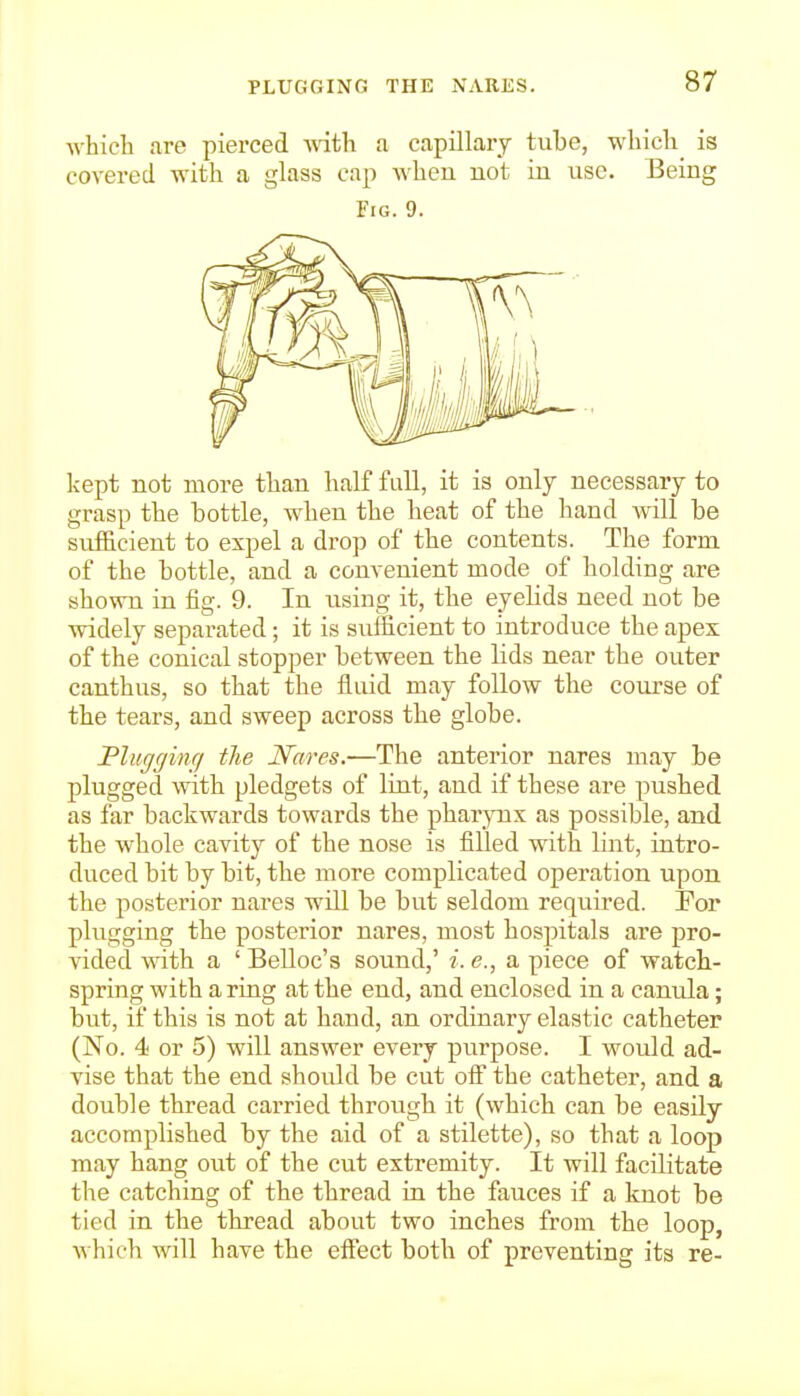 PLUGGING THE NARKS. Avhicli are pierced v.ith a capillary tube, wbicli is covered with a glass cap when not in use. Being Fig. 9. kept not more than half Ml, it is only necessary to grasp the bottle, when the heat of the hand will be suf&cient to expel a drop of the contents. The form of the bottle, and a convenient mode of holding are shown in fig. 9. In using it, the eyelids need not be widely separated; it is sufficient to introdvice the apex of the conical stopper between the lids near the outer canthus, so that the fluid may follow the course of the tears, and sweep across the globe. Pliigginfi tlie Nares.—The anterior nares may be plugged with pledgets of lint, and if these are pushed as far backwards towards the pharynx as possible, and the whole cavity of the nose is filled with lint, intro- duced bit by bit, the more complicated operation upon the posterior nares will be but seldom required. For plugging the posterior nares, most hospitals ai'e pro- vided with a 'Belloc's sound,' i.e., apiece of watch- spring with a ring at the end, and enclosed in a canula; but, if this is not at hand, an ordinary elastic catheter (No. 4 or 5) will answer every purpose. I would ad- vise that the end should be cut off the catheter, and a double thread carried through it (which can be easily accomplished by the aid of a stilette), so that a loop may hang out of the cut extremity. It will facilitate the catching of the thread in the fauces if a knot be tied in the tlu-ead about two inches from the loop, which will have the effect both of preventing its re-