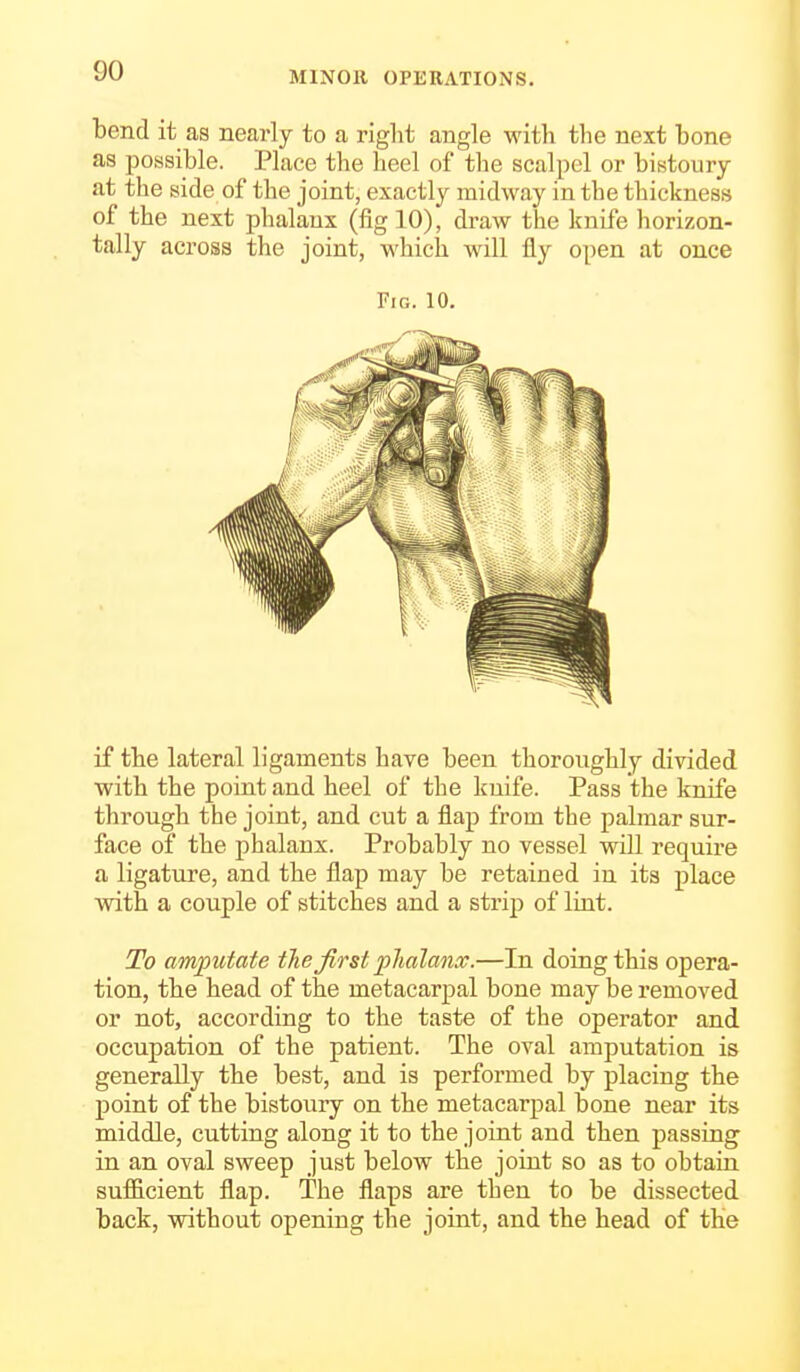 bend it as nearly to a right angle with the next bone as possible. Place the heel of the scalpel or bistoury at the side of the joint, exactly midway in the thickness of the next phalanx (fig 10), draw the knife horizon- tally across the joint, which will fly open at once Fig. 10. if the lateral ligaments have been thoroughly divided with the point and heel of the knife. Pass the knife through the joint, and cut a flap from the palmar sur- face of the phalanx. Probably no vessel will require a ligature, and the flap may be retained in its place with a couple of stitches and a strip of luit. To amputate the first phalanx.—In doing this opera- tion, the head of the metacarpal bone may be removed or not, according to the taste of the operator and occupation of the patient. The oval amputation is generally the best, and is performed by placing the point of the bistoury on the metacarpal bone near its middle, cutting along it to the joint and then passing in an oval sweep just below the joint so as to obtain sufficient flap. The flaps are then to be dissected back, without opening the joint, and the head of the