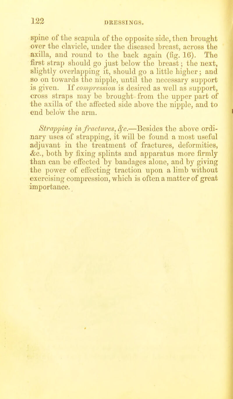 spine of tlie scapula of the opposite side, then brought over the clavicle, under the diseased breast, across the axilla, and round to the back again (fig. 16). The first strap should go just below the breast; the next, slightly overlapping it, should go a little higher; and so on tovsrards the nipple, until the necessary support is given. II coinj^-efision is desired as well as support, cross straps maybe brought from the upper part of the axilla of the affected side above the nipple, and to end below the arm. Strappinr/ injraciures, 8(c.—Besides the above ordi- nary uses of strapping, it will be found a most useful adjuvant in the treatment of fractures, deformities, &e., both by fixing splints and apparatus more firmly than can be effected by bandages alone, and by giving the power of eflcctiug traction upon a limb without exercising compression, which is often a matter of gi'eat importance.