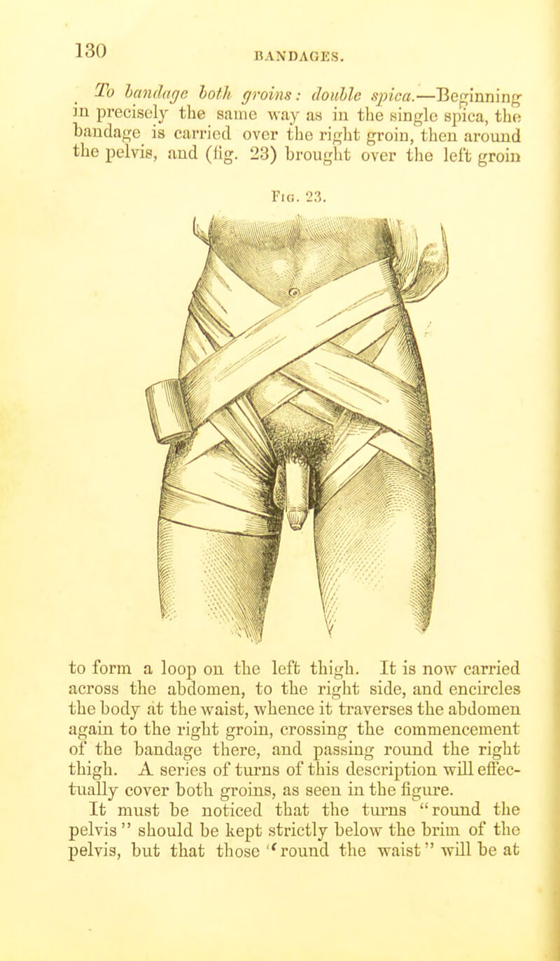 BANDAGES. To landage loth groins: double spica.—Bef^inninf^ in precisely the same way as in tlie single spica, the bandage is carried over the right groin, then around the pelvis, and (iig. 23) brought over the left groin Fig. 23. to form a loop on the left thigh. It is now carried across the abdomen, to the right side, and encircles the body at the waist, whence it traverses the abdomen again to the right groin, crossing the commencement of the bandage there, and passing round the right thigh. A series of turns of this description will effec- tually cover both groins, as seen in the figure. It must be noticed that the turns round the pelvis  should be kept strictly below the brim of the pelvis, but that those''round the waist will be at