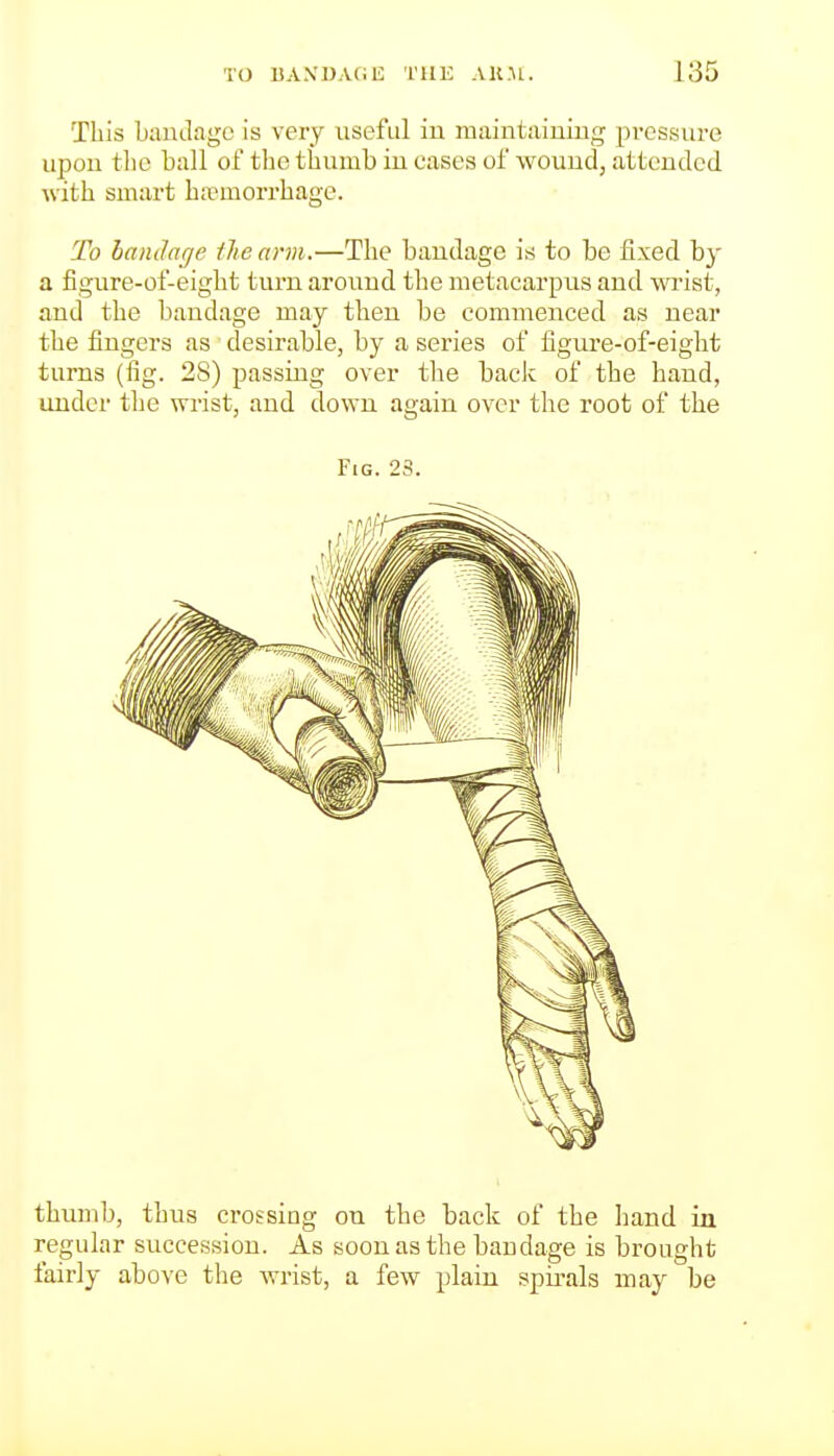 Tills baudage is very useful in maintaining pi'essure upon tlio ball of the thumb in cases of wound, attended, with smart hasmorrbage. To bandage the arm.—The bandage is to be fixed by a figure-of-eight turn around the metacarpus and wrist, and the bandage may then be commenced as near the fingers as desirable, by a series of figui'e-of-eight turns (fig. 28) passing over the bade of the hand, under tlie wrist, and down again over the root of the Fig. 23. thumb, thus crossing on the back of the hand in regular succession. As soon as the baudage is brought fairly above the wrist, a few plain spirals may be