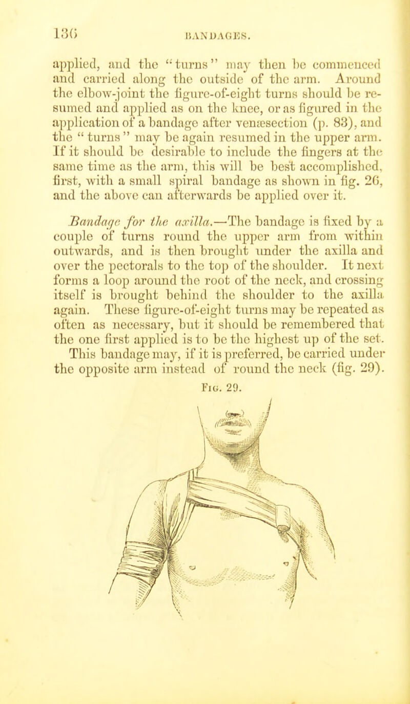 13() applied, niid the turns may then be commcuccd and carried along the outside of the arm. Around the elbow-joint the hgurc-of-cight turns should Ije re- sumed and applied as on the Ivuee, or as figured in the application of a bandage after vena?sectiou (]). 83), and the  turns  may be again resumed in the upper arm. If it should be desirable to include the fingers at the same time as the arm, this will be best accomplished, first, with a small spiral bandage as shown in fig. 26, and the above can afterwards be applied over it. Sandarjc for the axilla.—The bandage is fixed by a couple of turns round the upper arm from within outAvards, and is then brought imder the axilla and over the pectorals to the top of the shoulder. It next, foi'ms a loop around the root of the neck, and crossing itself is brought behind the shoulder to the axilla again. These figure-of-eight turns may be repeated as often as necessary, but it should be remembered that the one first applied is to be the highest up of the set. This bandage may, if it is preferred, be carried under the opposite arm instead of round the neck (fig. 29).
