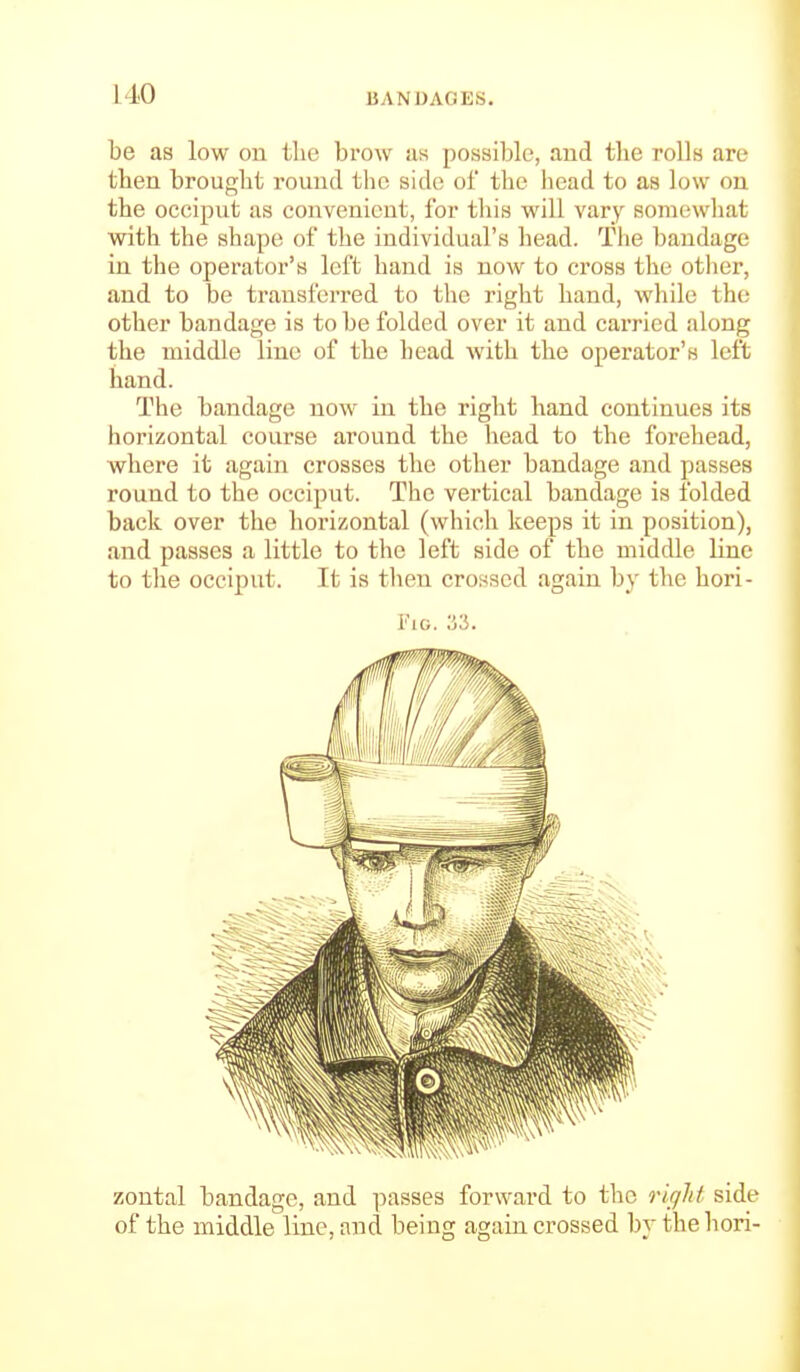 be as low on the brow as possible, and the rolls are then brought round the side of the head to as low on the occiput us convenient, for this will vary somewhat with the shape of the individual's head. The bandage in the operator's left hand is now to cross the other, and to be transferred to the right hand, while the other bandage is to be folded over it and carried along the middle line of the head with the operator's left hand. The bandage now in the right hand continues its horizontal course around the head to the forehead, where it again crosses the other bandage and passes round to the occiput. The vertical bandage is folded back over the horizontal (which keeps it in position), and passes a little to the left side of the middle line to the occiput. It is then crossed again by the hori- FiG. as. zontal bandage, and passes forward to the rifjld side of the middle line, and being again crossed by thehori-
