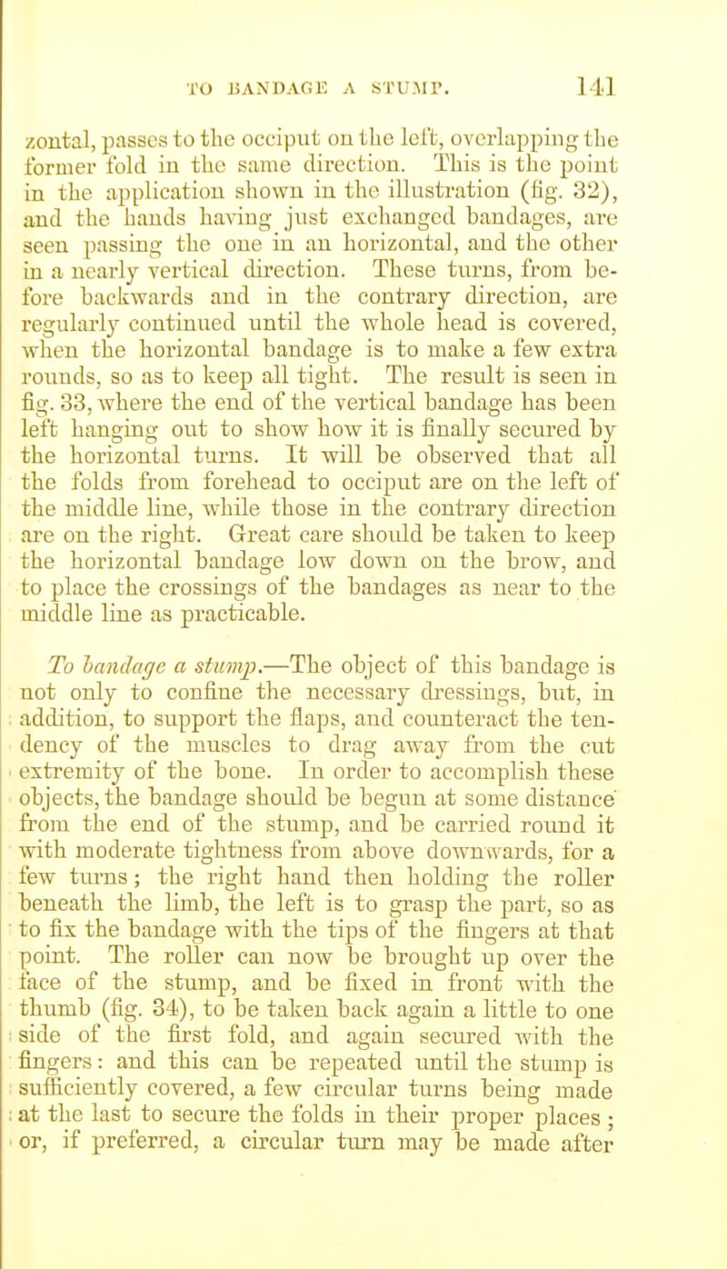 zontal, passes to the occiput on the left, ovcrhipping the former fokl in the same direction. This is the point in the application shown in the iUustration (hg. 32), and the hands having just exchanged bandages, are seen passing the one in an horizontal, and the other in a nearly vertical direction. These turns, from be- fore backwards and in the contrary direction, are regularl}^ continued until the whole head is covered, when the hoi'izontal bandage is to make a few extra rounds, so as to keej) all tight. The result is seen in fig. 33, where the end of the vertical bandage has been left hanging ovit to show how it is finally secured by the horizontal turns. It will be observed that all the folds from forehead to occiput are on the left of the middle line, while those in the contrary direction are on the right. G-reat care shoidd be taken to keep the horizontal bandage low down on the brow, and to place the crossings of the bandages as near to the middle line as practicable. To handctffe a stuvijp.—The object of this bandage is not only to confine the necessary di-essings, but, in addition, to support the flaps, and counteract the ten- dency of the muscles to drag away from the cut extremity of the bone. In order to accomplish these objects, the bandage should be begun at some distance from the end of the stump, and be carried round it with moderate tightness from above downwards, for a few turns; the right hand then holding the roller beneath the limb, the left is to grasp the part, so as to fix the bandage with the tips of the fingers at that point. The roUer can now be brought up over the face of the stump, and be fixed in front with the thumb (fig. 34), to be taken back again a little to one side of the first fold, and again secured vrith the fingers: and this can be repeated until the stump is sufiiciently covered, a few circular turns being made at the last to secure the folds in their proper places ; or, if preferred, a circular turn may be made after