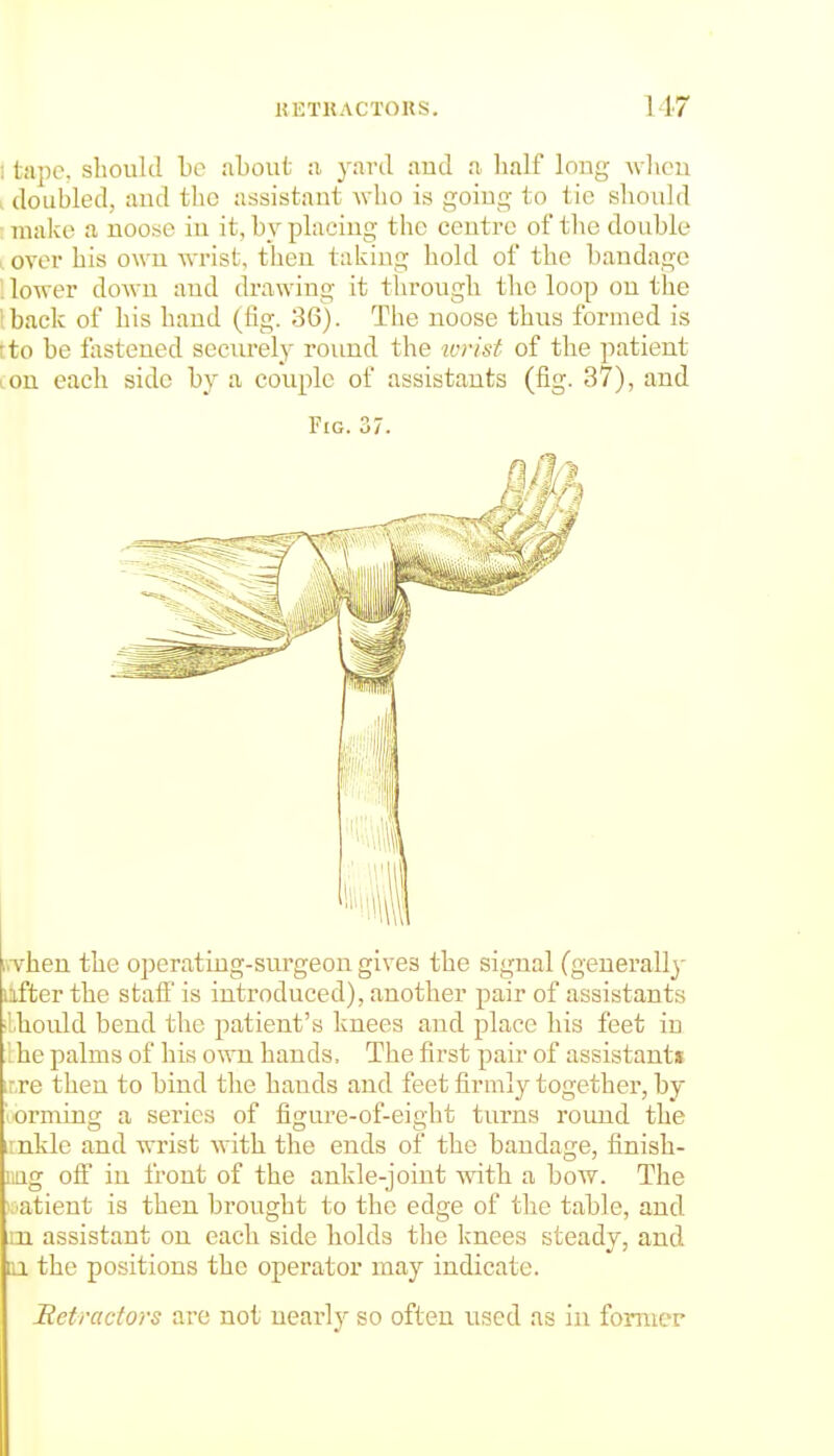 ! tape, should be iiLout :i yard aud :i lialf long whcu I doubled, aud the assistant who is goiug to tic sliould : make a noose iu it, b_v placing the centre of the double I over his own -wrist, then taking hold of the bandage '. lower down aud drawing it through the loop on the I back of his hand (lig. 36). The noose thus formed is tto be tastened securely round the torist of the patient I on each side by a couple of assistants (fig. 37), and Fig. 37. RTheu the operating-surgeon gives the signal (generall}- ilfter the stalf is introduced), another pair of assistants ■Ihonld bend the patient's knees and place his feet iu Lhe palms of his own hands, The first pair of assistants inre then to bind the hands and feet firmly togethei', by lOrmiug a series of figure-of-eight turns round the irnkle and wrist with the ends of the bandage, finish- nag off in front of the ankle-joint with a bow. The iL'atient is then brought to the edge of the table, and m assistant on each side holds the knees steady, and 01 the positions the operator may indicate. Retractors are not nearly so often used as in former