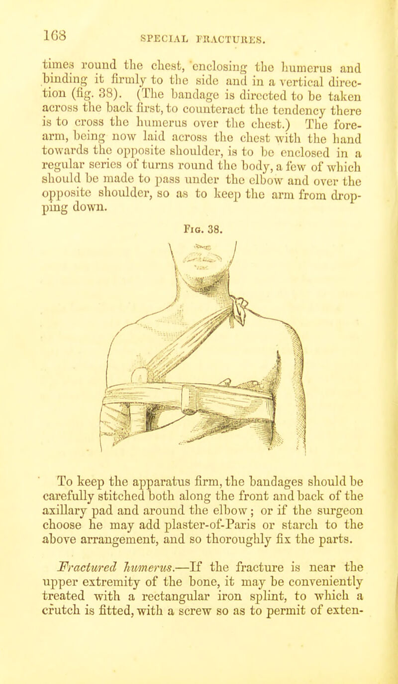 times round the chest, euclosing the humerus and binding it firmly to the side and in a vertical direc- tion (fig. 38). (The bandage is directed to be taken across the back first, to counteract the tendency there is to cross the humerus over the chest.) The fore- arm, being now laid across the chest with the hand towards the opposite shoulder, is to be enclosed in a regular series of turns round the body, a few of which should be made to pass under the elbow and over the opposite shoulder, so as to keep the arm from drop- ping down. Fig. 38. To keep the apparatus firm, the bandages should be carefully stitched both along the front and back of the a,xillary pad and around the elbow; or if the surgeon choose he may add plaster-of-Paris or starch to the above arrangement, and so thoroughly fix the parts. Fractured humerus.—If the fracture is near the upper extremity of the bone, it may be conveniently treated with a rectangular iron sj^lint, to which a crutch is fitted, with a screw so as to permit of exten-