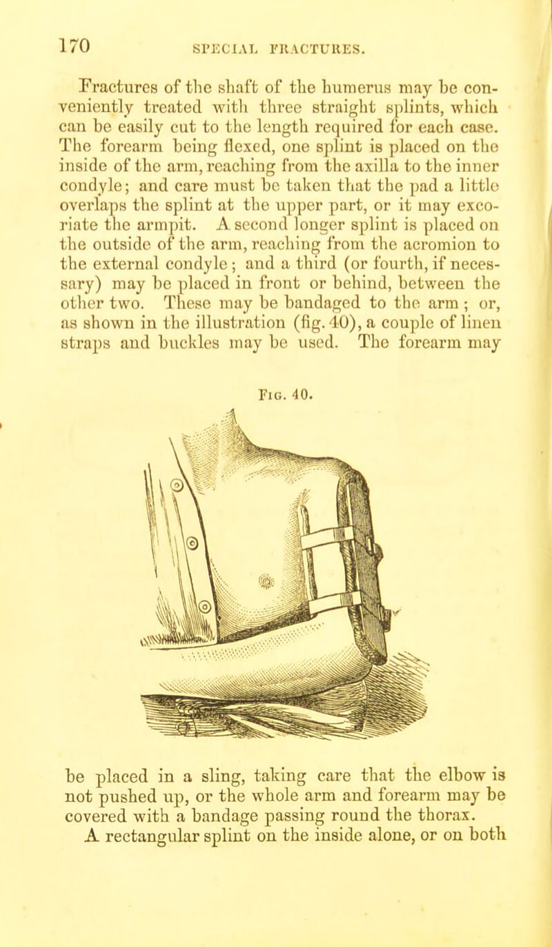 Fractures of the shaft of the humerus may be con- veniently treated witli three straight splints, which can be easily cut to the length required for each case. The forearm being flexed, one splint is placed on the inside of the arm, reaching from the axilla to the inner condyle; and care must be taken that the pad a little overlaps the splint at the upper part, or it may exco- riate tlie armpit. A second longer splint is placed on the outside of the arm, reaching from the acromion to the external condyle; and a third (or fourth, if neces- sary) may be placed in front or behind, between the other two. These may be bandaged to the arm ; or, as shown in the illustration (fig. 40), a couple of linen straps and buckles may be used. The forearm may Fig. 40. be placed in a sling, tailing care that the elbow is not pushed up, or the whole arm and forearm may be covered with a bandage passing round the thorax. A rectangular splint on the inside alone, or on botb