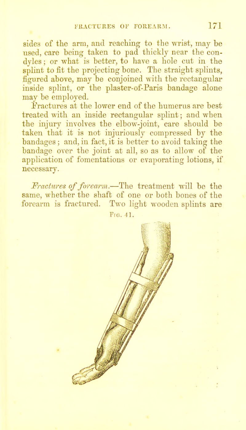 sides of the arm, .intl reaching to the wrist, may be used, care being taken to pad tliickly near tlie con- dyles ; or what is better, to have a hole cut in the splint to fit the projecting bone. The straight splints, figured above, may be conjoined with the rectangular inside splint, or the plaster-of-Paris bandage alone may be employed. fractures at the lower end of the humerus are best treated with an inside rectangular splint; and when the injury involves the elbow-joint, care should be taken that it is not injuriously compressed by the bandages; and, in fact, it is better to avoid taking the bandage over the joint at all, so as to allow of the application of fomentations or evaporating lotions, if necessary. Fractures of forearm.—The treatment will be the same, whether the shaft of one or both bones of the foreai-m is fractured. Two light wooden splints are Frc;. n.