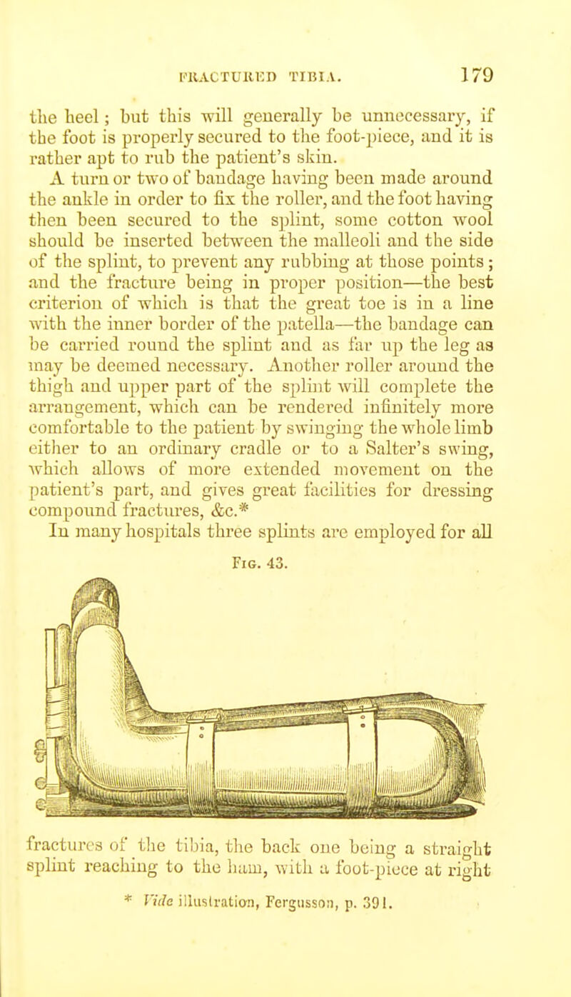 the heel; but this will generally be unnecessary, if the foot is properly secured to the foot-piece, and it is i-ather apt to rub the patient's skin. A turn or two of bandage having been made around the ankle in order to fix the roller, and the foot having then been secured to the S])lint, some cotton wool should be inserted between the malleoli and the side of the splint, to prevent any rubbing at those points; and the fracture being in proper position—the best criterion of which is that the great toe is in a line with the inner border of the patella—the bandage can be carried round the splint and as far up the leg as may be deemed necessary. Another roller around the thigh and upper part of the splint will complete the arrangement, which can be rendered infinitely more comfortable to the patient by swinging the whole limb either to an ordinary cradle or to a Salter's swing, Avhich allows of more extended movement on the patient's part, and gives great facilities for dressing compound fractures, &c.* In many hospitals three splints are employed for aU Fig. 43. fractures of the tibia, the back one being a straight splint reaching to the ham, with a foot-piece at right