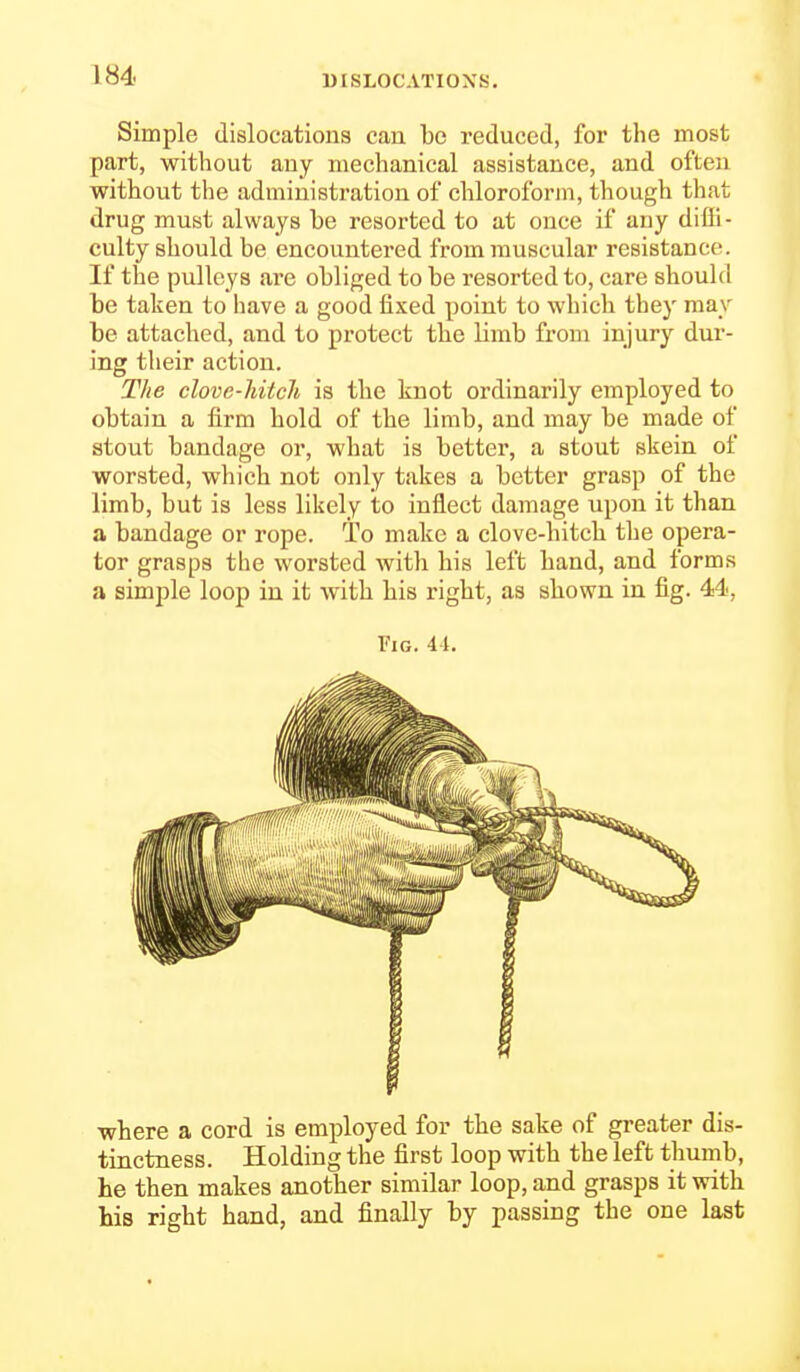 Simple dislocations can bo reduced, for the most part, without any mechanical assistance, and often without the administration of chloroform, though that drug must always be resorted to at once if any diffi- culty should be encountered from muscular resistance. If the pulleys are obliged to be resorted to, care should be taken to have a good fixed point to which they may be attached, and to protect tbe limb from injury dur- ing their action. The clove-hitch is the knot ordinarily employed to obtain a firm hold of the limb, and may be made of stout bandage or, what is better, a stout skein of worsted, which not only takes a better grasp of the limb, but is less likely to inflect damage upon it than a bandage or rope. To make a clove-hitch the opera- tor grasps the worsted witli his left hand, and forms a simple loop in it with his right, as shown in fig. 44, Fig. 41. where a cord is employed for the sake of greater dis- tinctness. Holding the first loop with the left thumb, he then makes another similar loop, and grasps it vdth his right hand, and finally by passing the one last