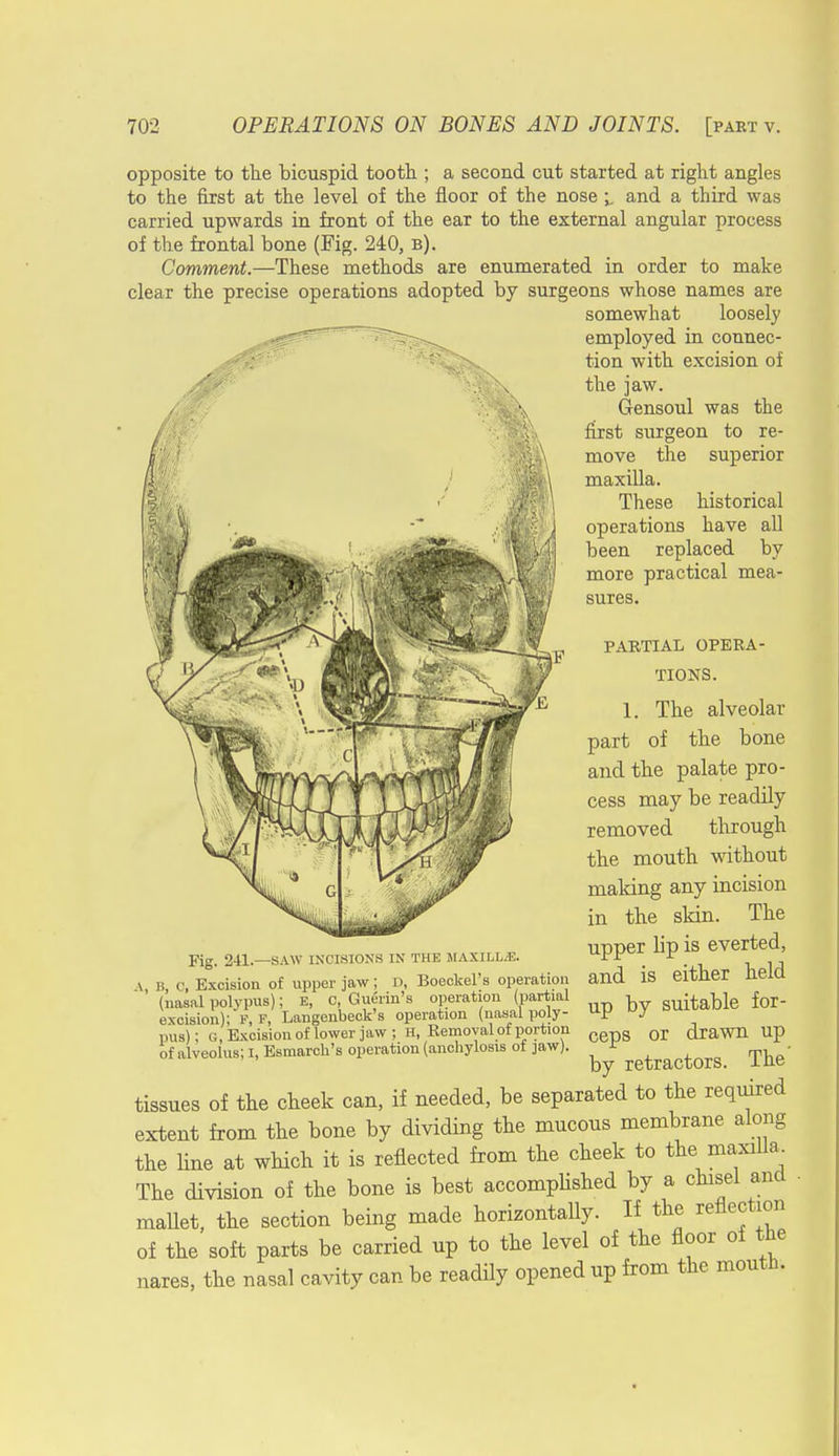 opposite to the bicuspid tooth ; a second cut started at right angles to the first at the level of the floor of the nose i and a third was carried upwards in front of the ear to the external angular process of the frontal bone (Fig. 240, b). Comment.—These methods are enumerated in order to make clear the precise operations adopted by surgeons whose names are somewhat loosely employed in connec- tion with excision of the jaw. Gensoul was the first surgeon to re- move the superior maxilla. These historical operations have all been replaced by more practical mea- sures. PARTIAL OPERA- TIONS. 1. The alveolar part of the bone and the palate pro- cess may be readily removed through the mouth without making any incision in the skin. The upper lip is everted, Fig. 241.—SAW INCISIONS IN THE MAXILLAE. L\F.f r \ b 0, Excision of upper jaw; D, Boeckel's operation and IS either held ' (nasal polypus); E, C Guerin's operation (partial , suitable for- excision); P, F, Langenbeck's operation (nasal poly- P y pus); g, Excision of lower jaw; h, Removal of portion g or drawn up of alveolus; I, Esmarch's operation (anchylosis of jaw). retractors The' tissues of the cheek can, if needed, be separated to the required extent from the bone by dividing the mucous membrane along the line at which it is reflected from the cheek to the maxilla. The division of the bone is best accomplished by a chisel and mallet, the section being made horizontally. If the reflection of the soft parts be carried up to the level of the floor oi the nares, the nasal cavity can be readily opened up from the mouth.