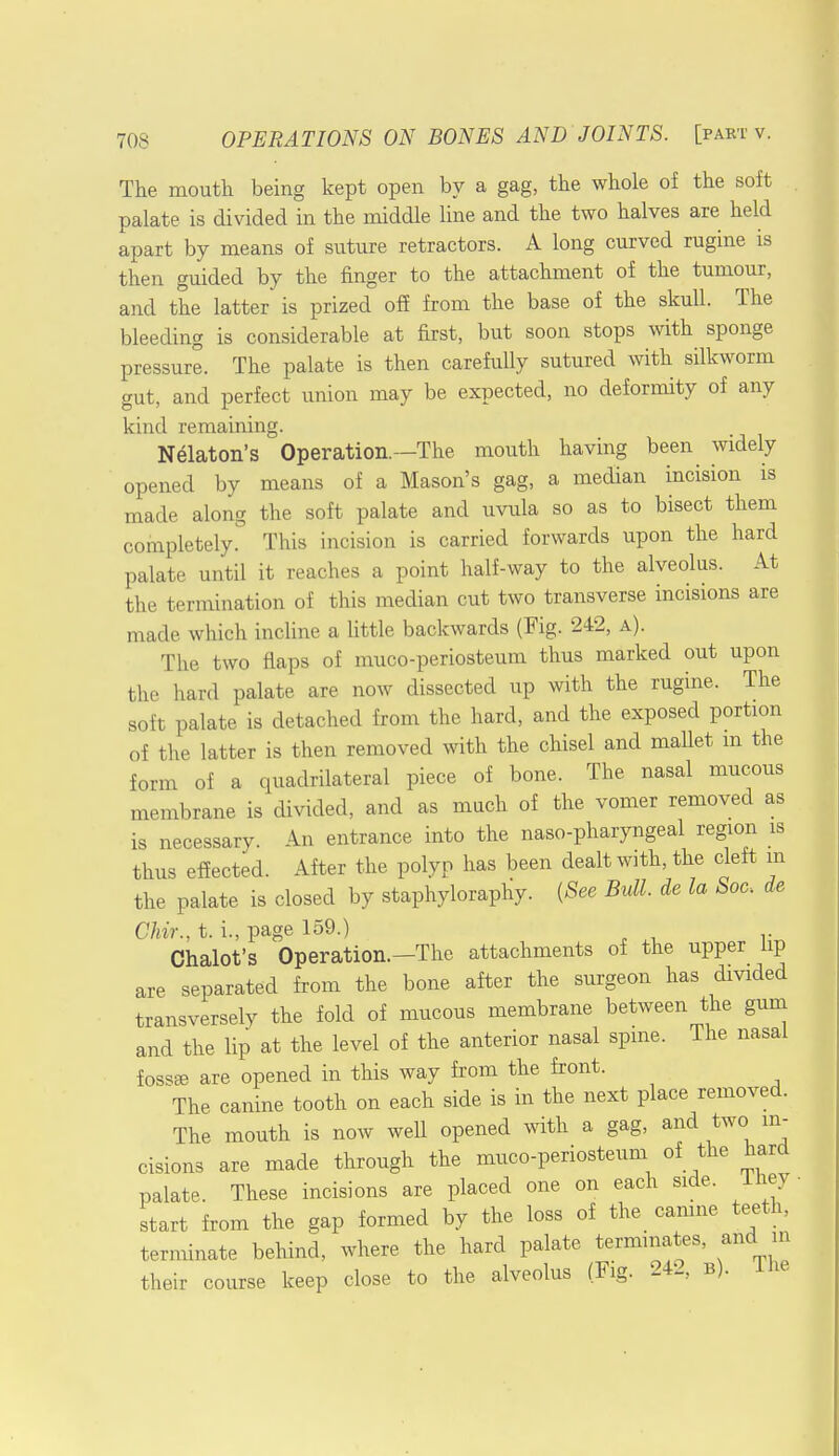 The mouth being kept open by a gag, the whole of the soft palate is divided in the middle line and the two halves are held apart by means of suture retractors. A long curved rugine is then guided by the finger to the attachment of the tumour, and the latter is prized off from the base of the skull. The bleeding is considerable at first, but soon stops with sponge pressure. The palate is then carefully sutured with silkworm gut, and perfect union may be expected, no deformity of any kind remaining. Nelaton's Operation.—The mouth having been widely opened by means of a Mason's gag, a median incision is made along the soft palate and uvula so as to bisect them completely. This incision is carried forwards upon the hard palate until it reaches a point half-way to the alveolus. At the termination of this median cut two transverse incisions are made which incline a little backwards (Fig. 242, a). The two flaps of muco-periosteum thus marked out upon the hard palate are now dissected up with the rugine. The soft palate is detached from the hard, and the exposed portion of the latter is then removed with the chisel and mallet m the form of a quadrilateral piece of bone. The nasal mucous membrane is divided, and as much of the vomer removed as is necessary. An entrance into the nasopharyngeal region is thus effected. After the polyp has been dealt with, the cleft in the palate is closed by staphyloraphy. (See Bull, de la Soc. de Chir., t. i., page 159.) Chalot's Operation.—The attachments of the upper lip are separated from the bone after the surgeon has divided transversely the fold of mucous membrane between the gum and the lip at the level of the anterior nasal spine. The nasal fossae are opened in this way from the front. The canine tooth on each side is in the next place removed. The mouth is now well opened with a gag, and two in- cisions are made through the muco-periosteum of the hard palate. These incisions are placed one on each side. They start from the gap formed by the loss of the canine teeth, terminate behind, where the hard palate terminates, andL in their course keep close to the alveolus (Fig. 24L, b).