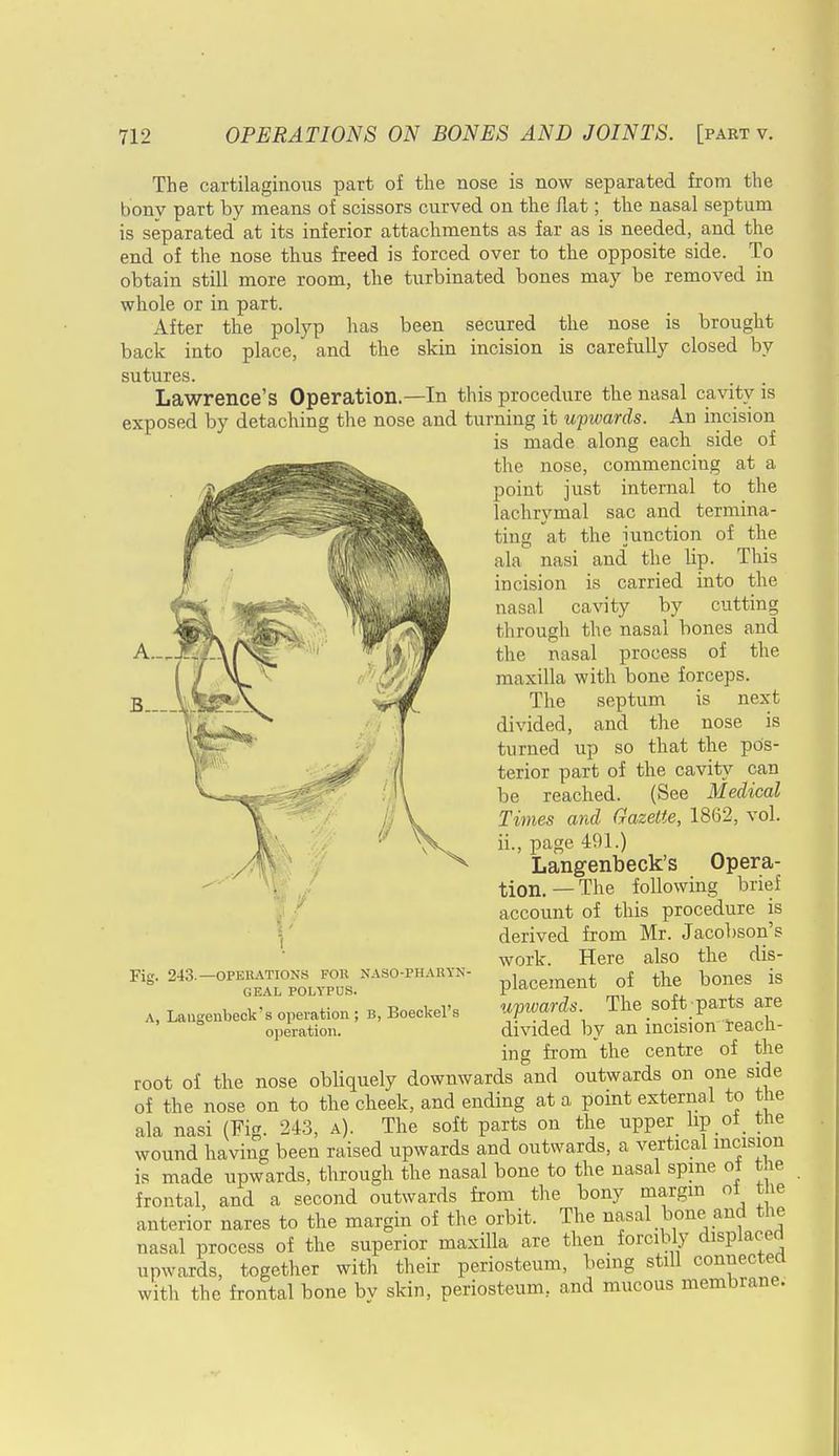 B.__ The cartilaginous part of the nose is now separated from the bonv part by means of scissors curved on the flat; the nasal septum is separated at its inferior attachments as far as is needed, and the end of the nose thus freed is forced over to the opposite side. To obtain still more room, the turbinated bones may be removed in whole or in part. After the polyp has been secured the nose is brought back into place, and the skin incision is carefully closed by sutures. Lawrence's Operation.—In this procedure the nasal cavity is exposed by detaching the nose and turning it upwards. An incision is made along each side of the nose, commencing at a point just internal to the lachrymal sac and termina- ting at the junction of the ala nasi and the lip. This incision is carried into the nasal cavity by cutting through the nasal bones and the nasal process of the maxilla with bone forceps. The septum is next divided, and the nose is turned up so that the pos- terior part of the cavity can be reached. (See Medical Times and Gazette, 1862, vol. ii., page 491.) Langenbeck's Opera- tion. — The following brief account of this procedure is derived from Mr. Jacobson's work. Here also the dis- placement of the bones is upivards. The soft-parts are divided by an incision reach- ing from the centre of the root of the nose obliquely downwards and outwards on one side of the nose on to the cheek, and ending at a point external to the ala nasi (Fig. 243, a). The soft parts on the upper lip oi the wound having been raised upwards and outwards, a vertical incision is made upwards, through the nasal bone to the nasal spme oi tfte frontal and a second outwards from the bony margin oi the anterior nares to the margin of the orbit. The nasal bone and the nasal process of the superior maxilla are then forcibly displaced upwards, together with their periosteum, being still connected with the frontal bone bv skin, periosteum, and mucous membrane. Fig. 243.—OPERATIONS FOR NASO-PHAKYN GEA1 POLYPUS. A, Langenbeck's operation ; B, Boeckel's operation.