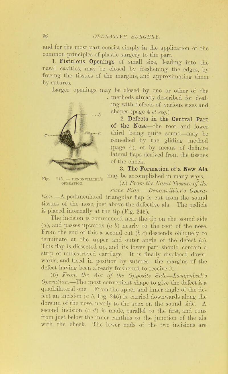 and for the most part consist simply in the application of the common principles of plastic surgery to the part, 1. Fistulous Opening's of small size, leading into the nasal cavities, may be closed by freshening the edges, by freeing the tissues of the margins, and approximating them by sutures. Larger openings may be closed by one or other of the . methods already described for deal- ing with defects of various sizes and shapes (page 4 et seq.). 2. Defects in the Central Part of the Nose—the root and lower third being quite sound—may be remedied by the gliding method (page 4), or by means of definite lateral flaps derived from the tissues of the cheek. 3. The Formation of a New Ala may be accomplished in many ways. (a) From tin- Na&al Tissues of the same Side — Denonvillier's Opera- tion.—X pedunculated triangular flap is cut from the sound tissues of the nose, just above the defective ala. The pedicle is placed internally at the tip (Fig. 245). The incision is commenced near the tip on the sound side (), and passes upwards (a b) nearly to the root of the nose. From the end of this a second cut (6 c) descends obliquely to terminate at the upper and outer angle of the defect (c). This flap is dissected up, and its lower part should contain a strip of nndestroyed cartilage. It is finally displaced down- wards, and fixed in position by sutures—the margins of the defect having been already freshened to receive it. (b) From the Ala of the Opposite Side—Langenbeck's Operation.—The most convenient shape to give the defect is a quadrilateral one. From the upper and inner angle of the de- fect an incision (a h, Fig. 246) is carried downwards along the dorsum of the nose, nearly to the apex on the sound side. A second incision (c d) is made, parallel to the first, and runs from just below the inner canthus to the junction of the ala with the cheek. The lower ends of the two incisions are Fig. 246. — DENOXVILLIKli's OPERATION.