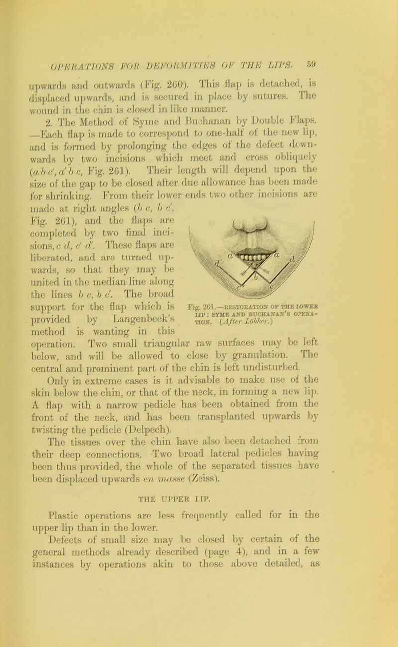 irpwarcU and outwards (Fig, 360). This flap is detached, is displaced upwards, anr] is secured in place by sutures. The wound in the chin is closed in like manner. 2. The Method of Syme and Buchanan by iJoublo Flaps. —Each flap is made to correspond to one-half of the new lip, and is formed by prolonging the edges of the defect down- wards by two incisions which meet and cross obliquely lab c',a'be, Fig. 201). Their length will depend upon the size of the gap to be closed after due allowance has been made for shrinking. From their lower ends two other incisions are made at right angles (b c, b <:', Fig. 201), and the flaps are completed by two final inci- sions, <■ <l, c! <L These flaps are liberated, and are turned up- wards, so that they may be united in the median line along the lines b <-,, b d. The broad support for the flap which is Fig. 2d.—restoration of the lower • 1 i , T i i , IAV: SYME AND BUCHANAN'S OPERA- provided by Langenbecks [AfterLobker.) method is wanting in this operation. Two small triangular raw surfaces may be left below, and will be allowed to close by granulation. The central and prominent part of the chin is left undisturbed. Only in extreme cases is it advisable to make use of the skin below the chin, or that of the neck, in forming a new Hp. A flap with a narrow pedicle has been obtained from the front of the neck, and has been transplanted upwards by twisting the pedicle (Delpech). The tissues over the chin have also been detached from their deep connections. Two broad lateral pedicles having been thus provided, the whole of the separated tissues have been displaced upwards r/a mawt (Zeiss). THE UPPEB MR Plastic operations are less frequently called for in the upper lip than in the lower. Defects of small size may be closed by certain of the general methods already described (page 4), and in a few instances by operations akin to those above detailed, as