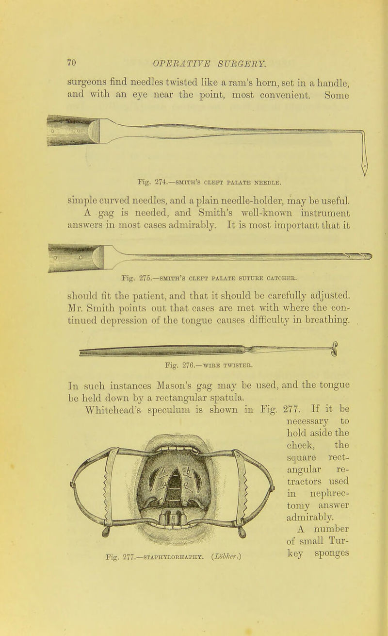 surgeons find needles twisted like a ram's horn, set in a handle, and with an eye near the point, most convenient. Some Fig. 274.—smith's cleft palate needle. simple curved needles, and a plain needle-holder, may be useful. A gag is needed, and Smith's well-known instrument answers in must eases admirably. It is most important that it Fig. 275.—smith's cleft palate suture catcheb. should til the patient, and that it should be carefully adjusted. Mr. Smith points oul that eases are met with where the con- tinned depression of the tongue causes difficulty inbreathing. . Fig. 276.—wire twister. In such instances Mason's gag may be used, and the tongue be held down by a rectangular spatula. Whitehead's speculum is shown in Fig. 277. If it be necessary to hold aside the cheek, the square rect- angular re- tractors used in nephrec- tomy answer admirably. A number of small Tur- Fig. 277.-STAPIITLORHAPHY. (Lobfor.) key sponges