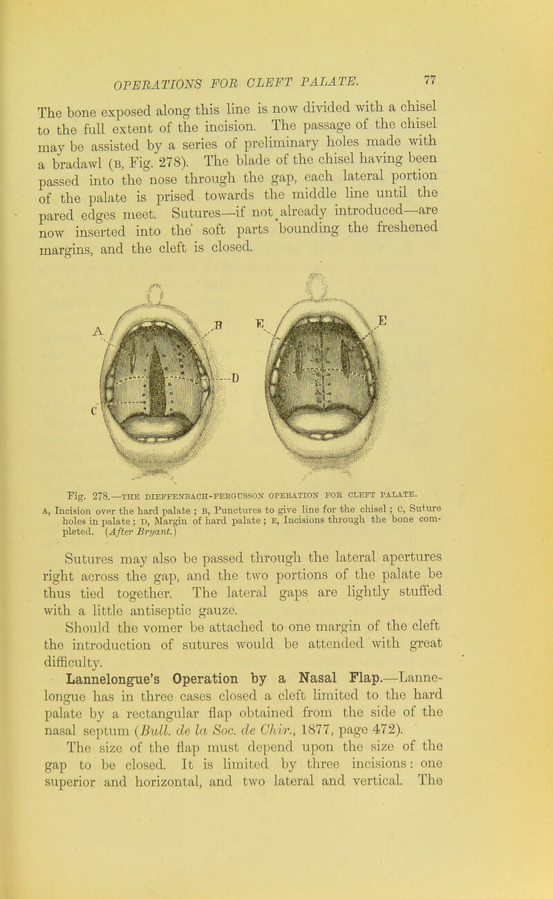 The bone exposed along this line is now divided with a chisel to the full extent of the incision. The passage of the chisel may be assisted by a series of preliminary holes made with a bradawl (b, Fig. 278). The blade of the chisel having been passed into the nose through the gap, each lateral portion of the palate is prised towards the middle line until the pared edges meet. Sutures—if not < already introduced—are now inserted into the soft parts 'bounding the freshened margins, and the cleft is closed. Fig. 278.—THE DIEFFENBACH-FEEGUSSON OPERATION FOE CLEFT PALATE. A, Incision over the hard palate ; B, Punctures to give line for the chisel; C, Suture holes in pala te; D, Margin of hard palate; E, Incisions through the bone com- pleted. (After Bryant.) Sutures may also be passed through the lateral apertures right across the gap, and the two portions of the palate be thus tied together. The lateral gaps are lightly stuffed with a little antiseptic gauze. Should the vomer be attached to one margin of the cleft the introduction of sutures would be attended with great difficulty. Lannelongue's Operation by a Nasal Flap.—Lanne- longue has in three cases closed a cleft limited to the hard palate by a rectangular flap obtained from the side of the nasal septum (Bull, cle la Soc. de Ghir., 1877, page 472). The size of the flap must depend upon the size of the gap to be closed. It is limited by three incisions: one superior and horizontal, and two lateral and vertical. The A E