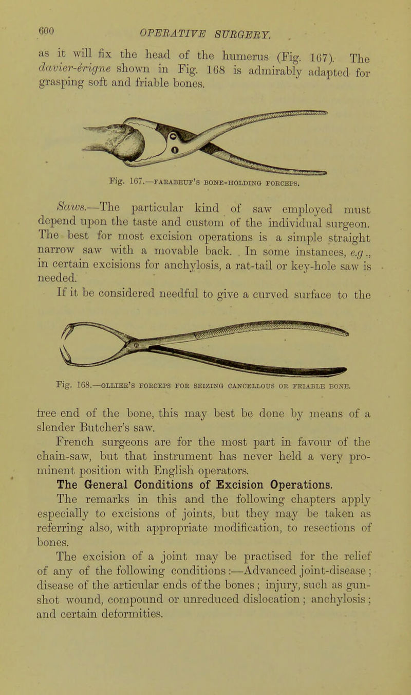 as it will fix the head of the humerus (Fig. 167). The davier-drigne shown in Fig. 168 is admirably adapted for grasping soft and friable bones. Fig. 167.—fababeot's bone-holdino foeceps. Saws.—The particular kind of saw employed must depend upon the taste and custom of the individual surgeon. The best for most excision operations is a simple straight narrow saw with a movable back. . In some instances, e.g., in certain excisions for anchylosis, a rat-tail or key-hole saw is needed. If it be considered needful to give a curved surface to the Fig. 168.—OLLIEE'S foeceps foe seizing OA^'CELLOUS OE FEIABLE BOXE. tree end of the bone, this may best be done by means of a slender Butcher's saw. French surgeons are for the most part in favour of the chain-saw, but that instrument has never held a very pro- minent position with English operators. The General Conditions of Excision Operations. The remarks in this and the following chapters apply especially to excisions of joints, but they ma}^ be taken as referring also, with appropriate modification, to resections of bones. The excision of a joint may be practised for the relief of any of the following conditions :—Advanced joint-disease ; disease of the articular ends of the bones; injury, such as gun- shot wound, compound or unreduced dislocation; anchylosis; and certain deformities.