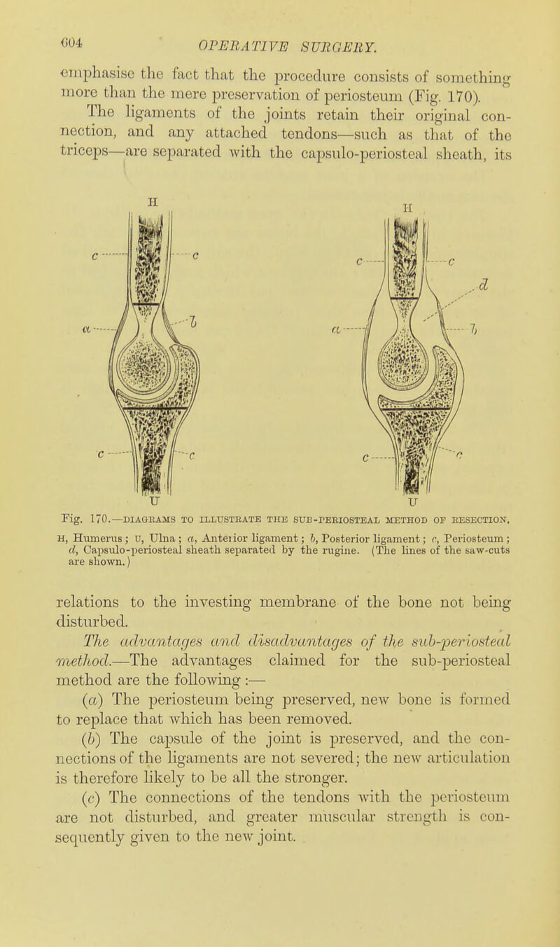 OPERA TI V.E 8 UJtGEliY. oniphcasise the fact that the procedure consists of something more than the mere preservation of periosteum (Fig. 170). The hgaments of the joints retain their original con- nection, and any attached tendons—such as that of the triceps—are separated with the capsulo-periosteal sheath, its Kg. 170.—DIAGEAMS TO ILLUSTEATE THE SUE-PEEIOSTEAL METHOD OP EESECTION. H, Humerus ; U, Ulna ; «, Antei ior ligament; h, Posterior ligament; r, Periosteum ; d, Capsulo-periosteal sheath separated by the rugiue. (The lines of the saw-cuts are shown.) relations to the investing membrane of the bone not being disturbed. Tlie advantages and disadvantages of the suh-periosteal method.—The advantages claimed for the sub-periosteal method are the following :— (a) The periosteum being preserved, new bone is formed to replace that which has been removed. (6) The capsule of the joint is preserved, and the con- nections of the ligaments are not severed; the new articulation is therefore likely to be all the stronger. (c) The connections of the tendons with the periosteum are not disturbed, and greater nuiscular strength is con- sequently given to the new joint.