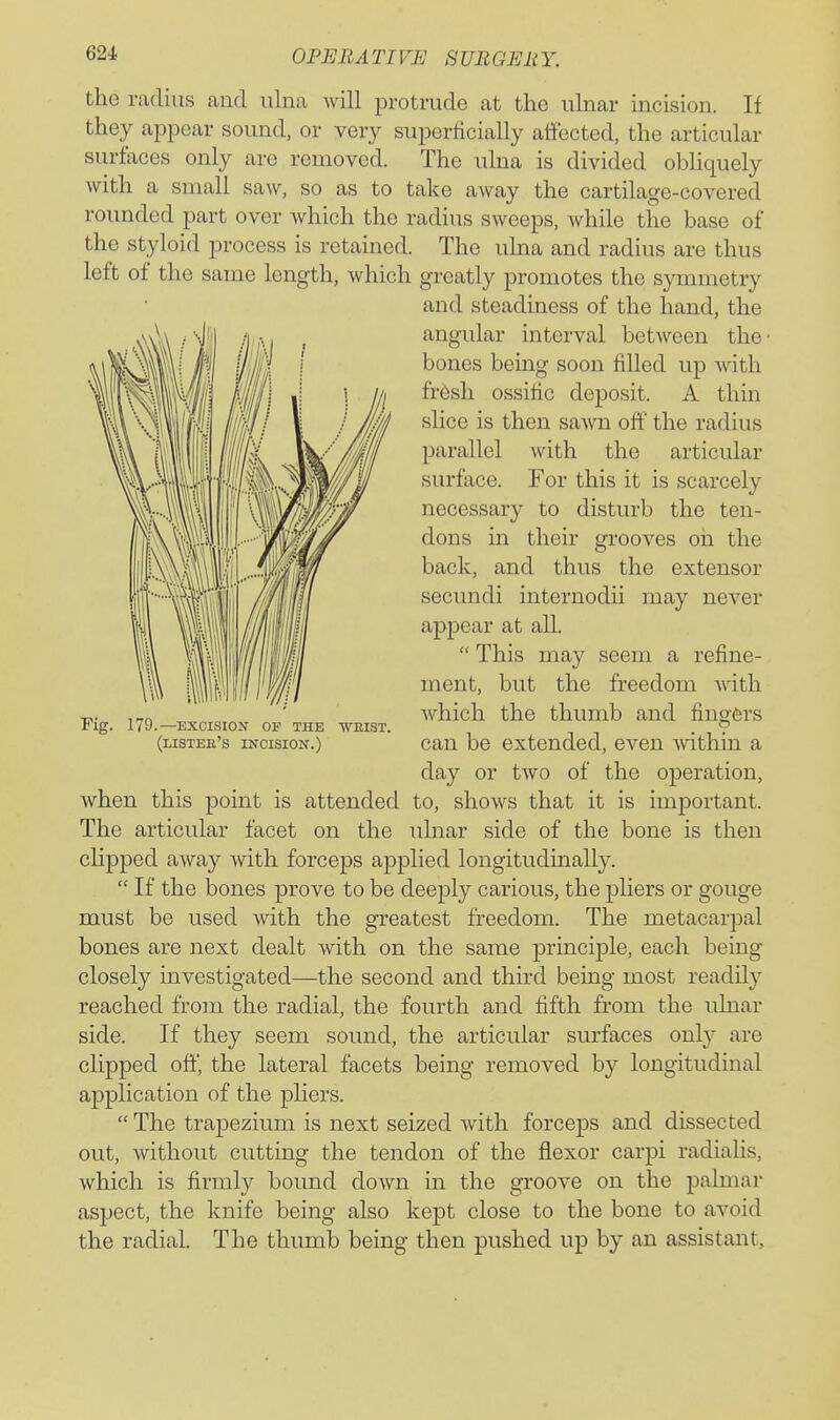 the radius and ulna will protrude at the ulnar incision. If they appear sound, or very superficially aifected, the articular surfaces only are removed. The ulna is divided obliquely with a small saw, so as to take away the cartilage-covered rounded part over which the radius sweeps, while the base of the styloid process is retained. The uhia and radius are thus left of the same length, which greatly promotes the symmetry and steadiness of the hand, the angular interval between the- bones bemg soon filled up with fr6sh ossific deposit. A thin slice is then sawn off the radius parallel with the articular surface. For this it is scarcely necessary to disturb the ten- dons in their grooves on the back, and thus the extensor secundi internodii may never appear at all. This may seem a refine- ment, but the freedom Avith Avhich the thumb and fingers can be extended, even Avithin a day or tAvo of the operation, when this point is attended to, shoAvs that it is important. The articular facet on the ulnar side of the bone is then clipped aAvay Avith forceps applied longitudinally. If the bones prove to be deeply carious, the pliers or gouge must be used Avith the greatest freedom. The metacarpal bones are next dealt Avith on the same principle, each being closely investigated—the second and third being most readily reached from the radial, the fourth and fifth from the ulnar side. If they seem sound, the articular surfaces only are clipped off, the lateral facets being removed by longitudinal application of the pliers. The trapezium is next seized Avith forceps and dissected out, Avithout cutting the tendon of the flexor carpi radialis, which is firmly bound doAvn in the groove on the palmar aspect, the knife being also kept close to the bone to avoid the radial. The thumb being then pushed up by an assistant, Fig. 179.—EXCISION OP THE WEIST. (listee's incision.)