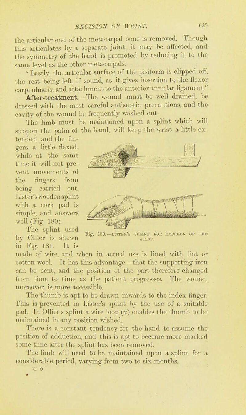 the articular end of the metacarpal bone is removed. Though this articulates by a separate joint, it may be affected, and the symmetry of the hand is promoted by reducing it to the same level as the other metacarpals.  Lastly, the articular surface of the pisiform is clipped oft', the rest being left, if sound, as it gives insertion to the flexor carpi ulnaris, and attachment to the anterior annular ligament. After-treatment.—The wound must be well drained, be dressed with the most carefid antiseptic precautions, and the cavity of the wound be frequently washed out. The limb must be maintained upon a splint which will support the palm of the hand, will keep the wrist a little ex- tended, and the fin- m 180.—lister's splint fob excision of WEIST. gers a little flexed, Avhile at the same time it will not pre- vent movements of the fingers from being carried out. Lister's wooden splint with a cork pad is simple, and ansAvers Avell (Fig. 180). The splint used by Oilier is shown in Fig. 18]. It is made of wire, and when in actual use is lined with lint or cotton-wool. It has this advantage—that the supporting iron can be bent, and the position of the part therefore changed from time to time as the patient progresses. The wound, moreover, is more accessible. The thumb is apt to be dra^vn inwards to the index finger. This is prevented in Lister's splint by the use of a suitable pad. In Oilier s splint a wire loop (a) enables the thumb to be maintained in any position wished. There is a constant tendency for the hand to assume the position of adduction, and this is apt to become more marked some time after the splint has been removed. The limb will need to be maintained upon a splint for a considerable period, varying from two to six months, o o