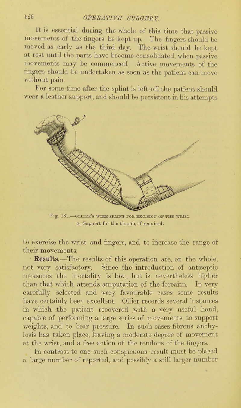 It is essential during the whole of this time that jjassive movements of the fingers be kept up. TIlo fingers should be moved as early as the third day. The wrist should be kept at rest until the parts have become consolidated, when passive movements may be commenced. Active movements of the fingers should be undertaken as soon as the patient can move without pain. For some time after the splint is left off, the patient should wear a leather support, and should be persistent in his attempts Fig. 181.—olliee's wibe splint foe excision of the weist. a, Supj)ort for the thumb, if required. to exercise the Avrist and fingers, and to increase the range of their movements. Results.—The results of this operation are, on the whole, not very satisfactory. Since the introduction of antiseptic measures the mortality is low, but is nevertheless higher than that which attends amputation of the foreaiin. In very carefully selected and very favourable cases some results have certainly been excellent. Oilier records several instances in which the patient recovered with a very useful hand, capable of performing a large series of movements, to support weights, and to bear pressure. In such cases fibrous anchy- losis has taken place, leaving a moderate degree of movement at the wrist, and a free action of the tendons of the fingers. In contrast to one such conspicuous result must be placed a large number of reported, and possibly a still larger number