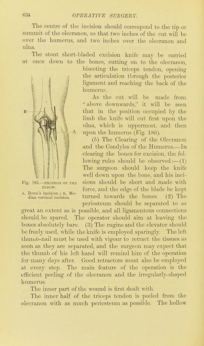 A The centre of the incision should correspond to the tip or summit of the olecranon, so that two inches of the cut will be over the humerus, and two inches over the olecranon and ulna. The stout short-bladed excision knife may be carried at once down to the bones, cutting on to the olecranon, bisecting the triceps tendon, opening the articvdation through the posterior ligament and reaching the back of the humerus. As the cut will be made from  above downwards, it will be seen that in the position occupied by the limb the knife will cut first u-pon the ulna, which is uppermost, and then upon the humerus (Fig. 186). (b) The Clearing of the Olecranon and the Condyles of the Humerus.—In clearing the bones for excision, the fol- lowing rules should be observed:—(1) The surgeon should keep the knife well down upon the bone, and his inci- sions should be short and made with force, and the edge of the blade be kept turned towards the bones. (2) The periosteum should be separated to as great an extent as is possible, and all ligamentous connections should be spared. The operator should aim at leaving the bones absolutely bare. (3) The rugine and the elevator shoidd be freely used, while the knife is employed sparingly. The left thumb-nail must be used with vigour to retract the tissues as soon as they are separated, and the surgeon may exj)ect that the thumb of his left hand will remind him of the operation for many days after. Good retractors must also be employed at every step. The main feature of the operation is the efficient peeling of the olecranon and the irregularly-shaped humerus. The inner part of the wound is first dealt with; The inner half of the triceps tendon is peeled ft-om the olecranon Avith as nuich periosteum as possible. The hollow Fi; f 185.—EXCISION OF THE ELBOW. A, Rou.\'s incision ; B, Me dian vertical incision.