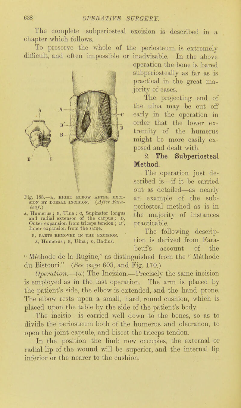 The complete subperiosteal excision is described in a, chapter which follows. To preserve the whole of the periosteum is extremely difficult, and often impossible or inadvisable. In the above operation the bone is bared subperiosteally as far as is practical in the great ma- jority of cases. The projecting end of the ulna may be cut off early in the operation in order that the lower ex- tremity of the humerus -c Fig. 188.—A, EIGHT ELBOW AFTEE EXCI- SION BY DOESAii INCISION. {After I'ara- bcif.) A, Humerus ; B, Ulna; o, Supinator longus and radial extensor of the carpus ; D, Outer expansion from triceps tendon ; d', Inner expansion from the same. B, PAETS EEMOVED IN THE EXCISION. A, Humerus ; B, Ulna ; C, Radius. might be more easily ex- posed and dealt with. 2. The Subperiosteal Method. The operation just de- scribed is—if it be carried out as detailed—as nearly an example of the sub- periosteal method as is in the majority of instances practicable. The following descrip- tion is derived from Fara- beufs account of the  Methode de la Rugine, as distinguished from the  Methode du Bistouri. {See page 603, and Fig. 170.) Operation.—(a) The Incision.—Precisely the same incision is employed as in the last operation. The arm is placed by the patient's side, the elbow is extended, and the hand prone. The elbow rests upon a small, hard, round cushion, Avhich is placed upon the table by the side of the patient's body. The incisio is carried well down to the bones, so as to divide the periosteum both of the humerus and olecranon, to open the joint capsule, and bisect the triceps tendon. In the position the limb now occupies, the external or radial lip of the wound will be superior, and the internal lip inferior or the nearer to the cushion.