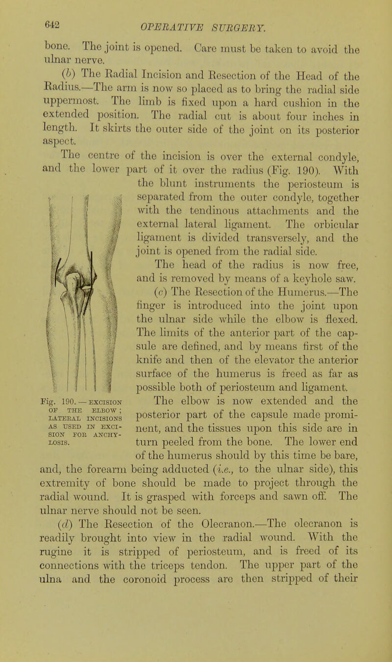 bone. The joint is opened. Care must be taken to avoid the iihiar nerve. (b) The Radial Incision and Resection of the Head of the Radius.—The arm is noAv so placed as to bring the radial side uppermost. The limb is fixed upon a hard cushion in the extended position. The radial cut is about four inches in length. It skirts the outer side of the joint on its posterior aspect. The centre of the incision is over the external condyle, and the lower part of it over the radhis (Fig. 190). With the blunt instruments the periosteum is separated from the outer condyle, together Avith the tendinous attachments and the external lateral ligament. The orbicular ligament is divided transversely, and the joint is opened from the radial side. The head of the radius is now free, and is removed by means of a keyhole saw. (6') The Resection of the Humerus.—The finger is introduced into the joint upon the ulnar side while the elbow is flexed. The limits of the anterior part of the cap- sule are defined, and by means first of the knife and then of the elevator the anterior surface of the humerus is freed as far as possible both of periosteum and ligament. The elbow is now extended and the posterior part of the capsule made promi- nent, and the tissues upon this side are in turn peeled from the bone. The lower end of the humerus should by this time be bare, and, the forearm being adducted (i.e., to the ulnar side), this extremity of bone should be made to project through the radial wound. It is grasped with forceps and sawn ofi'. The ulnar nerve should not be seen. (d) The Resection of the Olecranon.—The olecranon is readily brought into view in the radial wound. With the rugine it is stripped of periosteum, and is freed of its connections with the triceps tendon. The upper part of the ulna and. the coronoid process arc then stripped of their Fig. 190. — EXCISION OF THE ELBOW ; LATERAL INCISIONS AS USED IN EXCI- SION FOE ANCHY- LOSIS.