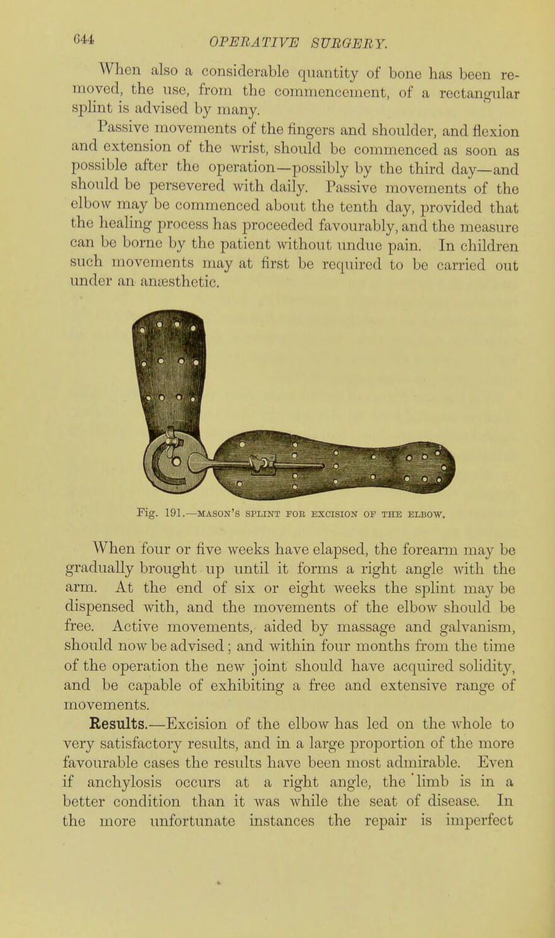 When also a considerable quantity of bone has been re- moved, the use, from the commencement, of a rectangular splint is advised by many. Passive movements of the fingers and shoulder, and flexion and extension of the wrist, should be commenced as soon as possible after the operation—possibly by the third day—and should be persevered with daily. Passive movements of the elbow may be commenced about the tenth day, provided that the healing process has proceeded favourably, and the measure can be borne by the patient without undue pain. In children such movements may at first be required to be carried out under an antesthetic. Fig. 191.—mason's splint fob excision of the elbow. When four or five weeks have elapsed, the forearm may be gradually brought up until it forms a right angle with the arm. At the end of six or eight weeks the splint may be dispensed with, and the movements of the elbow should be free. Active movements, aided by massage and galvanism, should now be advised; and within four months from the time of the operation the new joint should have acquired sohdity, and be capable of exhibiting a free and extensive range of movements. Results.—Excision of the elbow has led on the whole to very satisfactory results, and in a large proportion of the more favourable cases the residts have been most admirable. Even if anchylosis occurs at a right angle, the limb is in a better condition than it was while the seat of disease. In the more unfortunate instances the repair is imperfect