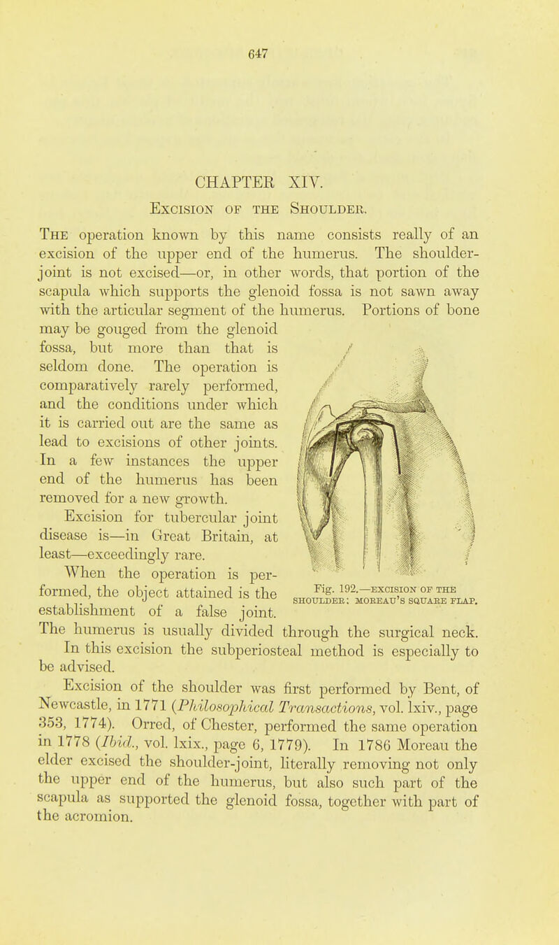 \ CHAPTER XIV. Excision of the Shoulder, The operation known by this name consists really of an excision of the upper end of the humerus. The shoulder- joint is not excised—or, in other words, that portion of the scapula which supports the glenoid fossa is not sawn away with the articular segment of the humerus. Portions of bone may be gouged from the glenoid fossa, but more than that is seldom done. The operation is comparatively rarely performed, and the conditions under which it is carried out are the same as lead to excisions of other joints. In a few instances the upper end of the humerus has been removed for a new growth. Excision for tubercular joint disease is—in Great Britain, at least—exceedingly rare. When the operation is per- formed, the object attained is the estabhshment of a false joint. The humerus is usually divided through the surgical neck. In this excision the subperiosteal method is especially to be advised. Excision of the shoulder was first performed by Bent, of Newcastle, in 1771 {Philosojyliical Transactions, vol. Ixiv., page 353, 1774). Orred, of Chester, performed the same operation in 1778 (Ibid., vol. Ixix., page 6, 1779). In 1786 Moreau the elder excised the shoulder-joint, hterally removing not only the upper end of the humerus, but also such part of the scapula as supported the glenoid fossa, together with part of the acromion. Fig. 192.—EXCISION OP THE shouldee; moeeau's squaee flap.