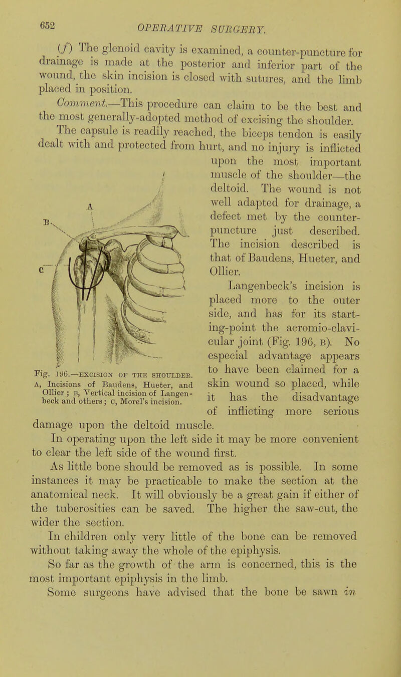 (/) The glenoid cavity is examined, a counter-puncture for drainage is made at the posterior and inferior part of the wound, the skin incision is closed with sutures, and the limb placed in position. Comment—This procedure can claim to be the best and the most generally-adopted method of excising the shoulder. The capsule is readily reached, the biceps tendon is easily dealt with and protected from hurt, and no injury is inflicted upon the most important t muscle of the shoulder—the deltoid. The Avound is not well adapted for drainage, a defect met by the counter- puncture just described. The incision described is that of Baudens, Hueter, and Oilier. Langenbeck's incision is placed more to the outer side, and has for its start- ing-point the acromio-clavi- cular jomt (Fig. 196, b). No especial advantage appears to have been claimed for a skin wound so placed, while it has the disadvantage of inflicting more serious damage upon the deltoid muscle. In operating upon the left side it may be more convenient to clear the left side of the wound first. As little bone should be removed as is possible. In some instances it may be j)racticable to make the section at the anatomical neck. It will obviously be a great gain if either of the tuberosities can be saved. The higher the saw-cut, the wider the section. In children only very little of the bone can be removed without taking away the whole of the epiphysis. So far as the growth of the arm is concerned, this is the most important epiphysis in the limb. Some surgeons have advised that the bone be sawn in Fig. IiJ6.—EXCISION OF THE SHOtTLDEE. A, Incisions of Baudens, Hueter, and Oilier ; B, Vertical incision of Langen- beck and others; c, Morel's incision.
