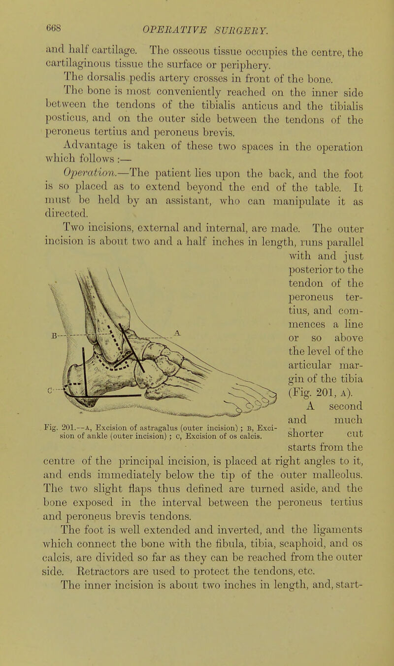 and half cartilage. The osseous tissue occupies the centre, the cartilaginous tissue the surface or periphery. The dorsalis pedis artery crosses in front of the bone. The bone is most conveniently reached on the inner side between the tendons of the tibialis anticus and the tibiahs posticus, and on the outer side between the tendons of the peroneus tertius and pcroneus brevis. Advantage is taken of these two spaces in the operation which follows :— Operation.—The patient lies upon the back, and the foot is so jalaced as to extend beyond the end of the table. It must be held by an assistant, who can manipulate it as directed. Two incisions, external and internal, are made. The outer incision is about two and a half inches in length, runs parallel with and just posterior to the tendon of the jseroneus ter- tius, and com- mences a line or so above the level of the articular mar- gin of the tibia (Fig. 201, A). A second and much Fig. 201.—A, Excision of astragalus (outer incision) ; B, Exci- if, f sion of ankle (outer incision) ; c, Excision of os calcis. SllOrter CUt starts from the centre of the principal incision, is placed at right angles to it, and ends immediately below the tip of the outer malleolus. The two slight flaps thus defined are turned aside, and the bone exposed in the interval between the peroneus tertius and peroneus brevis tendons. The foot is well extended and inverted, and the ligaments which connect the bone with the fibula, tibia, scaphoid, and os calcis, are divided so far as they can be reached from the outer side. Retractors are used to protect the tendons, etc. The inner incision is about two inches in length, and, start-