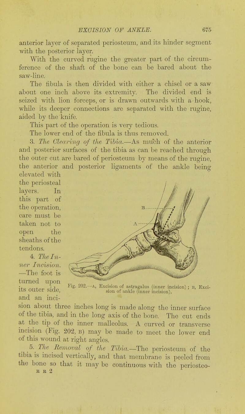 anterior layer of separated periosteum, and its hinder segment with the posterior layer. With the curved rugine the greater part of the circum- ference of the shaft of the bone can be bared about the saw-lme. The fibula is then divided with either a chisel or a saw about one inch above its extremity. The divided end is seized with lion forceps, or is drawn outwards with a hook, wliile its deeper connections are separated with the rugine, aided by the knife. This part of the operation is very tedious. The lower end of the fibula is thus removed. 3. The Glearmg of the Tibia.—As much of the anterior and posterior surfaces of the tibia as can be reached through the outer cut are bared of periosteum by means of the rugine, the anterior and posterior ligaments of the ankle being- elevated with the periosteal layers. In this part of the operation, care must be taken not to open the sheaths of the tendons. 4. The In- ner Incision. —The foot is turned upon its outer side, and an inci- sion about three inches long is made along the inner surface of the tibia, and in the long axis of the bone. The cut ends at the tip of the inner malleolus. A curved or transverse incisi^on (Fig. 202, b) may be made to meet the lower end of this wound at right angles. 5. The Removal of the Tibia.—The periosteum of the tibia is incised vertically, and that membrane is peeled from the bone so that it may be continuous with the periosteo- R R 2 Fig. 202.—A, Excision of astragalu.s (inner incision) ; B, sion of ankle (inner incision). Exci-