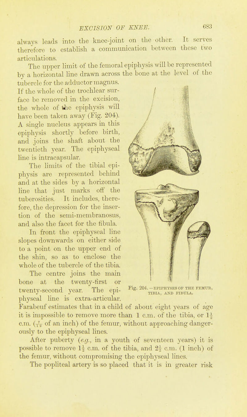 always leads into the knee-joint on the other. It serves therefore to establish a conununication between these two articulations. The upper limit of the femoral epiphysis will be represented by a horizontal line drawn across the bone at the level of the tubercle for the adductor magnus. If the whole of the trochlear sur- face be removed in the excision, the whole of tiae epiphysis will have been taken away (Fig. 204). A single nucleus appears in this epiphysis shortly before birth, and joins the shaft about the twentieth year. The epiphyseal line is intracapsular. The hmits of the tibial epi- physis are represented behind and at the sides by a horizontal line that just marks off the tuberosities. It includes, there- fore, the depression for the inser- tion of the semi-membranosus, and also the facet for the fibula. In front the epiphyseal line slopes downwards on either side to a point on the upper end of the shin, so as to enclose the whole of the tubercle of the tibia. The centre joins the main bone at the twenty-first or twenty-second year. The epi- physeal line is extra-articular. Farabeuf estimates that in a child of about eight years of age it is impossible to remove more than 1 cm. of the tibia, or 1| cm. (yV of inch) of the femur, without approaching danger- ously to the epiphyseal lines. After puberty (e.g., in a youth of seventeen years) it is possible to remove 1| cm. of the tibia, and 2| cm. (1 inch) of the femur, without compromising the epiphyseal lines. The pojjliteal artery is so placed that it is in greater risk Fig. 204. —EPIPHYSES OF THE FEMUIt, TIBIA, AND FIBULA,
