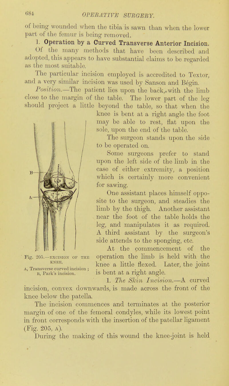 of being wounded when the tibia is sawn than when the lower part of the femur is being removed. 1. Operation by a Curved Transverse Anterior Incision. Of the many methods that have been described and adopted, this appears to have substantial claims to be regarded as the most suitable. The particular incision employed is accredited to Textor, and a very similar incision was used by Sanson and Begm. Position.—The patient lies upon the back,, with the limb close to the margin of the table. The lower part of the leg should project a little beyond the table, so that when the knee is bent at a right angle the foot may be able to rest, fiat upon the sole, upon the end of the table. The surgeon stands upon the side to be operated on. Some surgeons prefer to stand upon the left side of the limb in the case of either extremity, a position which is certainly more convenient for sawing. One assistant places himself oppo- site to the surgeon, and steadies the limb by the thigh. Another assistant near the foot of the table holds the leg, and manipulates it as required. A third assistant by the surgeon's side attends to the sponging, etc. At the commencement of the operation the limb is held with the knee a little flexed. Later, the joint Fig. 205.—EXCISION or the KNEE. A, Transverse curved incision ; B, Park's incision. is bent at a right angle. 1. The SJdn Incision.—A curved incision, convex downwards, is made across the front of the knee below the patella. The incision commences and terminates at the posterior margin of one of the femoral condyles, while its lowest point in front corresponds with the insertion of the patellar ligament (Fig. 205, A). During the making of this wound the Imee-joint is held
