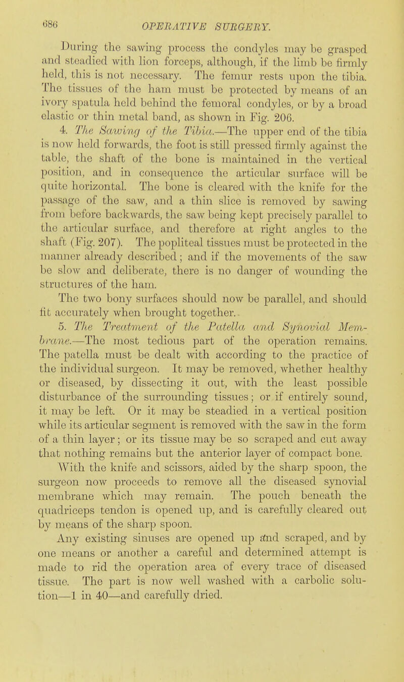 During the sawing process the condyles may be grasped and steadied with hon forceps, although, if the hnib be firmly held, this is not necessar}'-. The femur rests upon the tibia. The tissues of the ham must be protected by means of an ivory spatula held behind the femoral condyles, or by a broad elastic or thin metal band, as shown in Fig. 206. 4. The Sawing of the Tibia.—The upper end of the tibia is now held forwards, the foot is still pressed firmly against the table, the shaft of the bone is maintained in the vertical position, and in consequence the articular surface will be quite horizontal. The bone is cleared with the knife for the passage of the saw, and a thin slice is removed by sawing from before backwards, the saw being kept precisely parallel to the articular surface, and therefore at right angles to the shaft (Fig. 207). The popliteal tissues must be protected in the manner already described; and if the movements of the saw be slow and deliberate, there is no danger of wounding the structures of the ham. The two bony surfaces should now be parallel, and should fit accurately when brought together.. 5. The Treatment of tlie Patella and Synovial Mem- brane.—The most tedious part of the operation remains. The patella must be dealt with according to the practice of the individual surgeon. It may be removed, whether healthy or diseased, by dissecting it out, with the least possible disturbance of the surrounding tissues; or if entirely sound, it may be left. Or it may be steadied in a vertical position while its articular segment is removed with the saw m the form of a thin layer; or its tissue may be so scraped and cut away that nothing remains but the anterior layer of compact bone. With the knife and scissors, aided by the sharp spoon, the surgeon now proceeds to remove all the diseased sjoiovial membrane which may remain. The pouch beneath the quadriceps tendon is opened up, and is carefully cleared out by means of the sharp spoon. Any existing sinuses are opened up rfnd scraped, and by one means or another a careful and determined attempt is made to rid the operation area of every trace of diseased tissue. The part is now well washed with a carbolic solu- tion—1 in 40—and carefully dried.