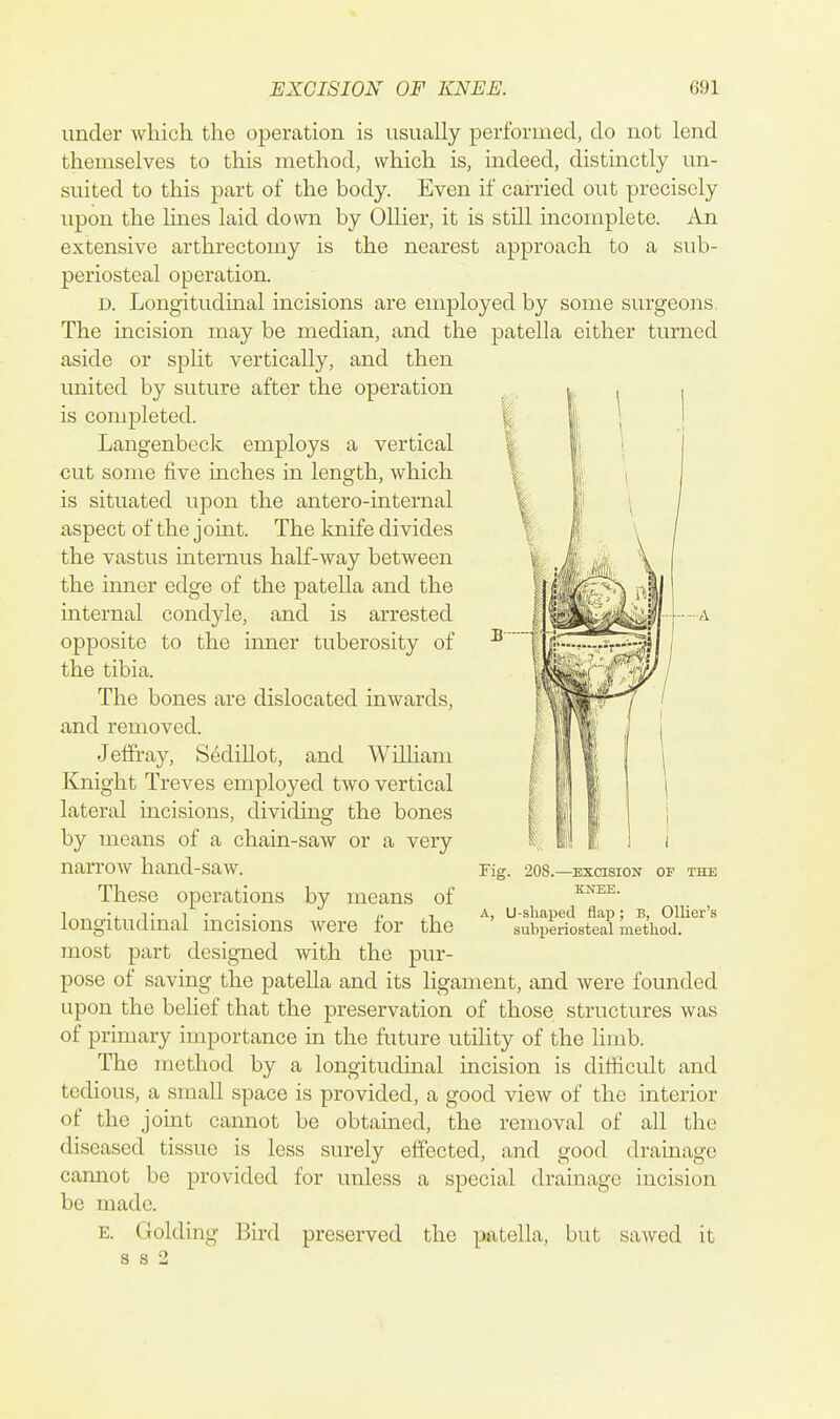 under which the operation is usually performed, do not lend themselves to this method, which is, mdeed, distinctly un- suited to this part of the body. Even if carried out precisely upon the lines laid down by Oilier, it is still incomplete. An extensive arthrectomy is the nearest approach to a sub- periosteal operation. D. Longitudinal incisions are employed by some surgeons The incision may be median, and the patella either turned aside or split vertically, and then united by suture after the operation is completed. Langenbeck employs a vertical cut some five inches in length, which is situated upon the antero-internal aspect of the j oint. The knife divides the vastus internus half-way between the inner edge of the patella and the internal condyle, and is arrested opposite to the inner tuberosity of the tibia. The bones are dislocated inwards, and removed. Jeffray, Sedillot, and William Knight Treves employed two vertical lateral incisions, dividing the bones by means of a chain-saw or a very narrow hand-saw. These operations by means of longitudinal incisions were for the most part designed with the pur- pose of saving the patella and its ligament, and were founded upon the behef that the preservation of those structures was of primary importance in the future utility of the limb. The method by a longitudinal incision is difficult and tedious, a small space is provided, a good view of the interior of the joint cannot be obtained, the removal of all the diseased tissue is less surely effected, and good drainage cannot be provided for unless a special drainage incision be made. E. Golding Bird preserved the patella, but sawed it s 3 2 Fig. 208.—EXCISION OF THE KNEE. A, U-sliaped flap; B, Ollier's subi)eriosteal method.
