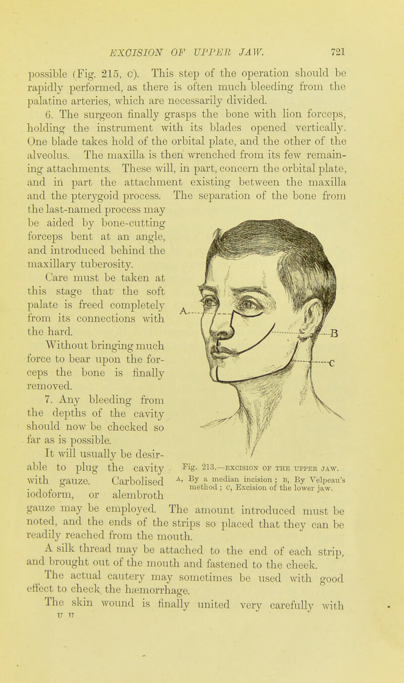 possible (Fig. 215, c). This step of the operation should be rapidly performed, as there is often much bleeding from the palatine arteries, Avhich are necessarily divided. 6. The surgeon finally grasjos the bone with lion forceps, holding the instrument with its blades opened vertically. One blade takes hold of the orbital plate, and the other of the alveolus. The maxilla is then wrenched from its few remain- ing attachments. These Avill, in part, concern the orbital plate, and in part the attachment existing between the maxilla and the pterygoid process. The separation of the bone from the last-named process may be aided by bone-cutting forceps bent at an angle, and introduced behind the maxillary tuberosity. Care must be taken at this stage that the soft palate is freed completely from its connections with the hard. Without bringing much force to bear upon the for- ceps the bone is finally removed. 7. Any bleeding from the depths of the cavity should now be checked so far as is possible. It will usually be desir- able to plug the cavity Avith gauze. Carbolised iodoform, or alembroth gauze may be employed. The amount introduced nmst be noted, and the ends of the strips so placed that they can be readily reached from the mouth. A silk thread may be attached to the end of each strip, and^ brought out of the mouth and fastened to the cheek. The actual cautery may sometimes be used Avith good effect to check the htemorrhage. The skin Avound is finally united very carefully Avith Fig. 213.—EXCISION OF THE TJPPEB JAW. A, By a median incision ; B, By Velpeaii's method ; c, Excision of the lower jaw. U IT