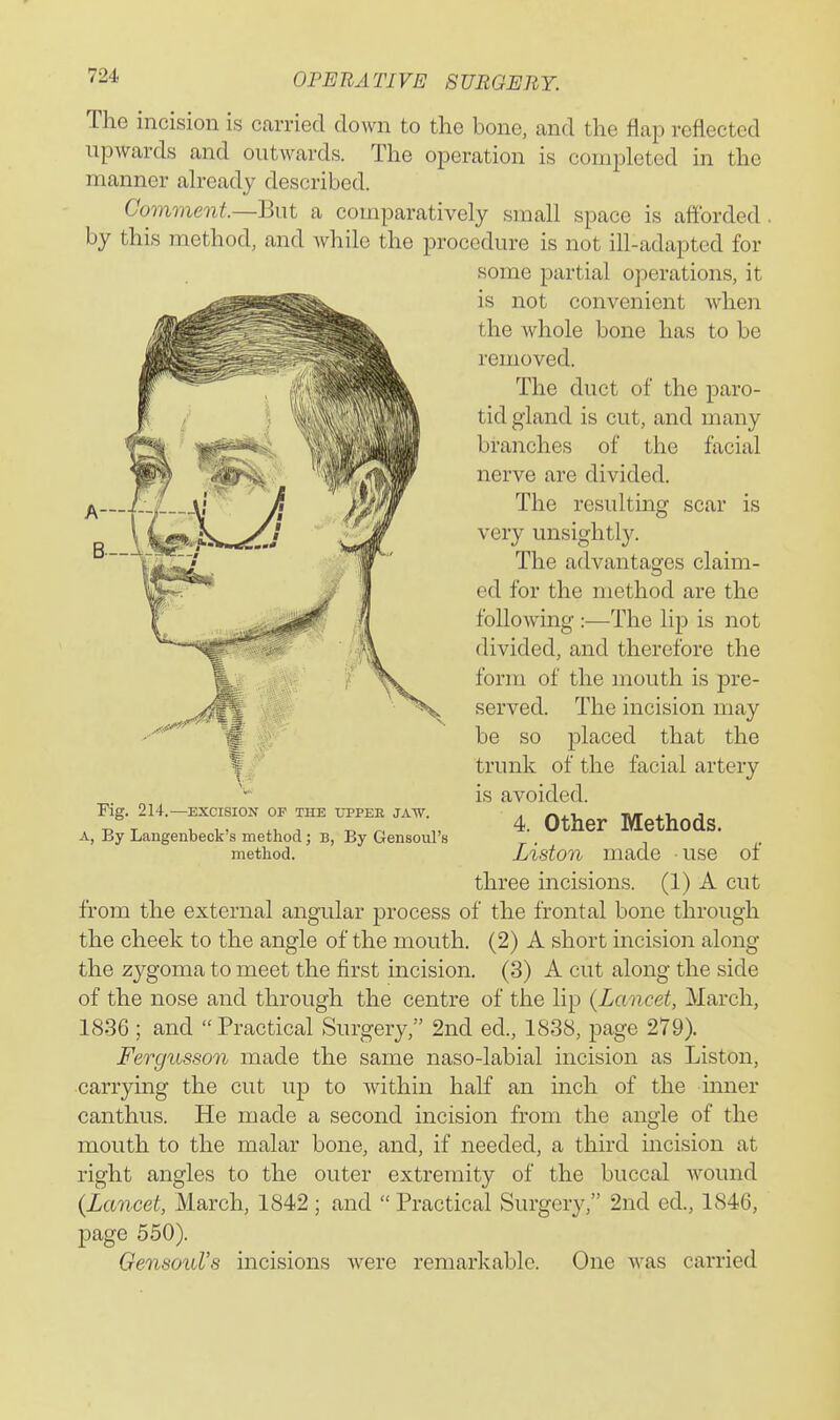 The incision is carried down to the bone, and the flap reflected upwards and outwards. The operation is completed in the manner already described. Comment.—But a comparatively small space is afforded, by this method, and while the procedure is not ill-adapted for some partial operations, it is not convenient Avhen the whole bone has to be removed. The duct of the paro- tid gland is cut, and many branches of the facial nerve are divided. The resulting scar is very unsightly. The advantages claim- ed for the method are the following :■—-The lip is not divided, and therefore the form of the mouth is pre- served. The incision may be so placed that the trunk of the facial artery is avoided. 4. Other Methods. Liston made use of three incisions. (1) A cut from the external angular process of the frontal bone through the cheek to the angle of the mouth. (2) A short incision along the zygoma to meet the first incision. (3) A cut along the side of the nose and through the centre of the lip {Lancet, March, 1836 ; and Practical Surgery, 2nd ed., 1838, page 279). Fergusson made the same naso-labial incision as Liston, carrying the cut up to within half an inch of the inner canthus. He made a second incision from the angle of the mouth to the malar bone, and, if needed, a third incision at right angles to the outer extremity of the buccal wound (Lancet, March, 1842 ; and  Practical Surgery, 2nd ed., 1846, page 550). GensouVs incisions were remarlvablc. One was carried Fig. 214.—EXCISION OF THE upper jaw. A, By Langenbeck's method; B, By Gensoul's method.