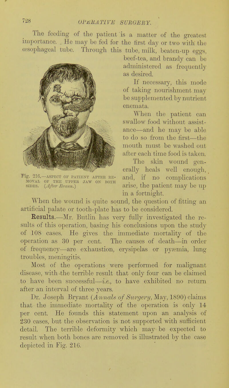 01'J<illATlVE SURGERY. The feeding of the patient 'is a matter of the greatest importance. . He may be fed for the tirst day or two with the cBSophageal tube. Through this tube, milk, beaten-up eggs, beef-tea, and brandy can be administered as frequently as desired. If necessary, this mode of taking nourishment ma}- be supplemented by nutrient enemata. AVhen the patient can swallow food without assist- ance—and he may be able to do so from the first—the mouth nuist be Avashed out after each time food is taken. The skin wound gen- erally heals well enough, _ Fig. 21G.-ASPECT OF PATiEXT AFTEE KE- and, If uo comphcatious MOVAL OF THE UPPER JAW OX BOTH . , . , SIDES. {After Bnmn.) arisc, the patient may be up in a fortnight. When the wound is quite sound, the question of fitting an artificial palate or tooth-plate has to be considered. Results.—Mr. Butlin has very fully investigated the re- sults of this operation, basing his conclusions upon the study of 108 cases. He gives the immediate mortality of the operation as 30 per cent. The causes of death—m order of frequency—are exhaustion, erj'-sipelas or pyaemia, lung troubles, meningitis. Most of the operations were performed for malignant disease, with the terrible result that only four can be claimed to have been successful—i.e., to have exhibited no return after an interval of three years. Dr. Joseph Bryant {Annals of Surgery, May, 1890) claims that the immediate mortality of the operation is only 14 per cent. He founds this statement upon an anal3-sis of 230 cases, but the observation is not supported with sufiicient detail. The terrible deformity which may be expected to result Avhen both bones arc removed is illustrated by the case depicted in Fig. 216.