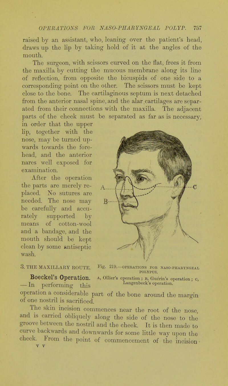 raised by an assistant, who, leaning over the patient's head, draws up the lip by taking hold of it at the angles of the mouth. The surgeon, with scissors curved on the flat, frees it from the maxilla by cutting the mucous membrane along its line of reflection, fr-om opposite the bicuspids of one side to a corresponding point on the other. The scissors must be kept close to the bone. The cartilaginous septum is next detached from the anterior nasal spine, and the alar cartilages are separ- ated from their connections with the maxilla. The adjacent parts of the cheek must be separated as far as is necessary, in order that the upper hp, together with the nose, may be turned up- wards towards the fore- head, and the anterior nares well exposed for examination. After the operation the parts are merely re- placed. No sutures are needed. The nose may be carefully and accu- rately supported by means of cotton-wool and a bandage, and the mouth should be kept clean by some antiseptic wash. Fig. 219.—OPEEATIONS FOE NASO-PHABTNGEAL POLYPUS. A, Ollier's operation ; b, Guerin's operation; c, Langenbeck's operation. 3. THE MAXILLARY ROUTE. Boeckel's Operation. — In performing this operation a considerable part of the bone around the margin of one nostril is sacrificed. The skm mcision commences near the root of the nose, and is carried obliquely along the side of the nose to the groove between the nostril and the cheek. It is then made to curve backwards and downwards for some little way upon the cheek. From the point of commencement of the incision T V