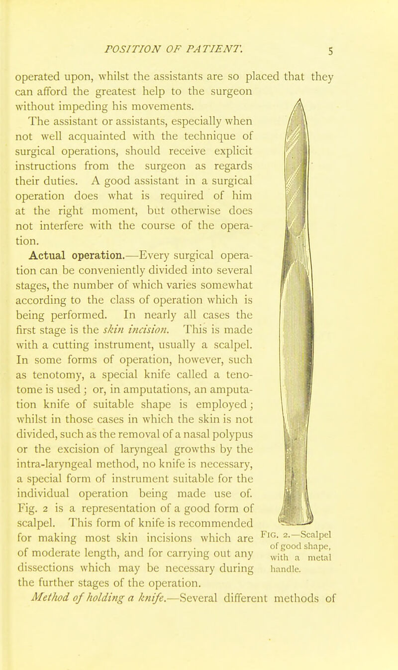 POSITION OF PATIENT. operated upon, whilst the assistants are so placed that they can afford the greatest help to the surgeon without impeding his movements. The assistant or assistants, especially when not well acquainted with the technique of surgical operations, should receive explicit instructions from the surgeon as regards their duties. A good assistant in a surgical operation does what is required of him at the right moment, but otherwise does not interfere with the course of the opera- tion. Actual operation.—Every surgical opera- tion can be conveniently divided into several stages, the number of which varies somewhat according to the class of operation which is being performed. In nearly all cases the first stage is the skin ificision. This is made with a cutting instrument, usually a scalpel. In some forms of operation, however, such as tenotomy, a special knife called a teno- tome is used ; or, in amputations, an amputa- tion knife of suitable shape is employed; whilst in those cases in which the skin is not divided, such as the removal of a nasal polypus or the excision of laryngeal growths by the intra-laryngeal method, no knife is necessary, a special form of instrument suitable for the individual operation being made use of. Fig. 2 is a representation of a good form of scalpel. This form of knife is recommended for making most skin incisions which are of moderate length, and for carrying out any dissections which may be necessary during the further stages of the operation. Method of holditig a knife.—Several different methods of I Fig. 2.—Scalpel of good shape, with a metal handle.