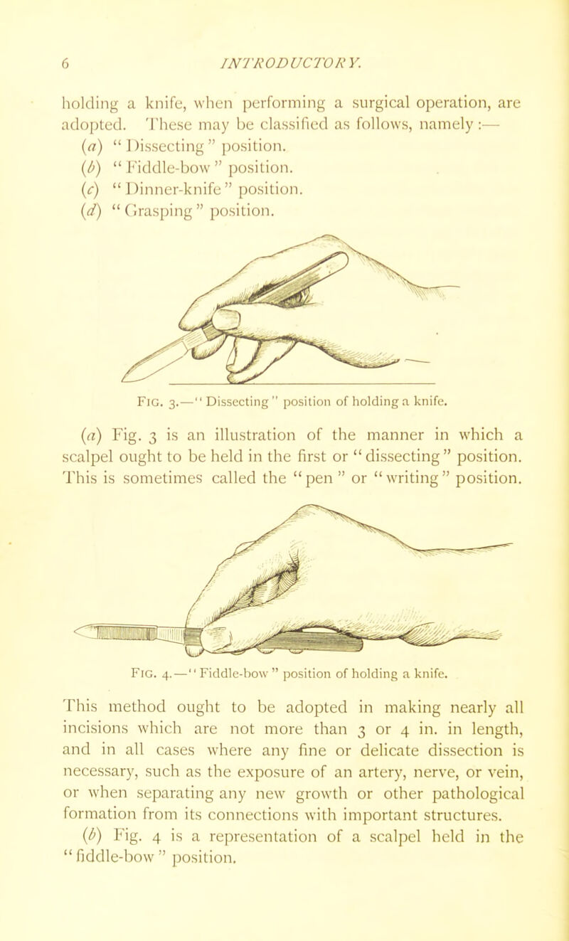 holding a knife, when performing a surgical operation, are adopted. 'J'hese may be classified as follows, namely :■— {a)  Dissecting  position. {b)  Fiddle-bow  position. {c) Dinner-knife position. {d)  Grasping  position. Fig. 3. —  Dissecting position of holding a knife. {(i) Fig. 3 is an illustration of the manner in which a scalpel ought to be held in the first or dissecting position. This is sometimes called the pen  or writing position. Fig. 4.— Fiddle-bow  position of holding a knife. This method ought to be adopted in making nearly all incisions which are not more than 3 or 4 in. in length, and in all cases where any fine or delicate dissection is necessary, such as the exposure of an artery, nerve, or vein, or when separating any new growth or other pathological formation from its connections with important structures. {b) Fig. 4 is a representation of a scalpel held in the fiddle-bow position.