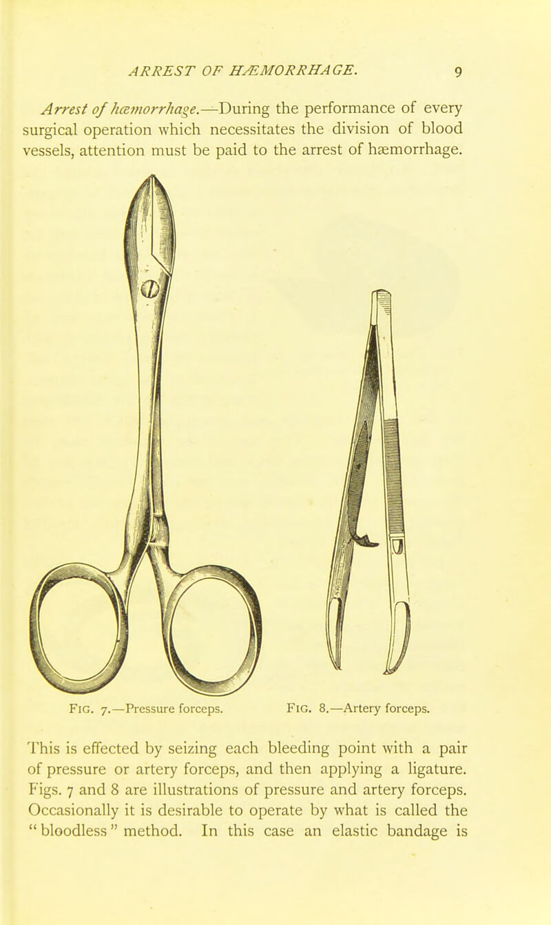Arrest of hczmorrJiaoe.—Dnnng the performance of every surgical operation which necessitates the division of blood vessels, attention must be paid to the arrest of hcemorrhage. Fig. 7.—Pressure forceps. Fig. 8.—Artery forceps. This is effected by seizing each bleeding point with a pair of pressure or artery forceps, and then applying a ligature. Figs. 7 and 8 are illustrations of pressure and artery forceps. Occasionally it is desirable to operate by what is called the  bloodless method. In this case an elastic bandage is
