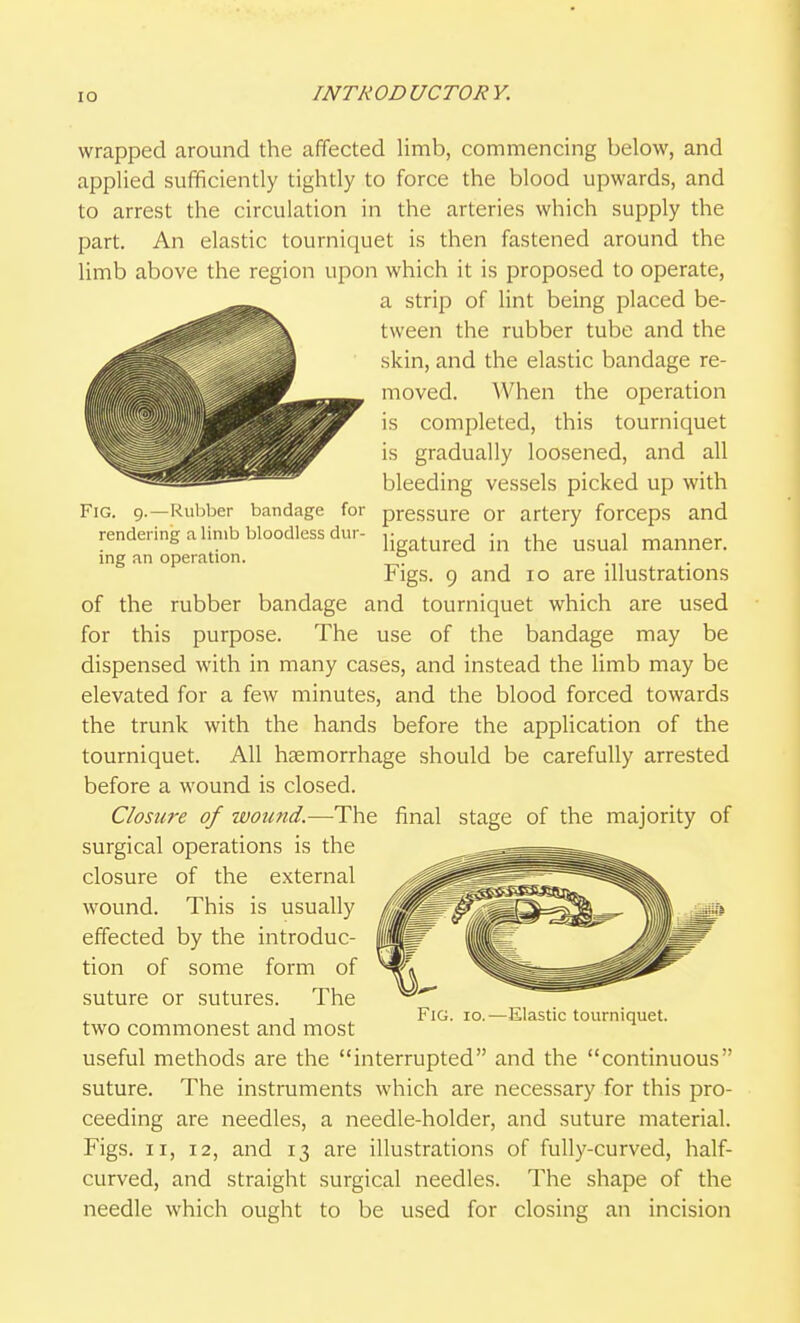 lO wrapped around the affected limb, commencing below, and applied sufficiently tightly to force the blood upwards, and to arrest the circulation in the arteries which supply the part. An elastic tourniquet is then fastened around the limb above the region upon which it is proposed to operate, a strip of lint being placed be- tween the rubber tube and the skin, and the elastic bandage re- moved. When the operation is completed, this tourniquet is gradually loosened, and all bleeding vessels picked up with Fig. 9.—Rubber bandage for pressure or artery forceps and rendering a limb bloodless dur- jw^.g^ -^^ ^j.^ ^,^^1 manner, ing an operation. ° .... Figs. 9 and 10 are illustrations of the rubber bandage and tourniquet which are used for this purpose. The use of the bandage may be dispensed with in many cases, and instead the limb may be elevated for a few minutes, and the blood forced towards the trunk with the hands before the application of the tourniquet. All haemorrhage should be carefully arrested before a wound is closed. Closiii-e of wound.—The final stage of the majority of surgical operations is the closure of the external wound. This is usually effected by the introduc- tion of some form of suture or sutures. The two commonest and most useful methods are the interrupted and the continuous suture. The instruments which are necessary for this pro- ceeding are needles, a needle-holder, and suture material. Figs. II, 12, and 13 are illustrations of fully-curved, half- curved, and straight surgical needles. The shape of the needle which ought to be used for closing an incision Fig. 10.—Elastic tourniquet.