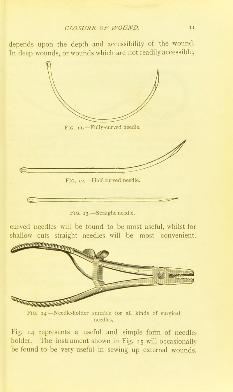 CLOSURE OF WOUND. n depends upon the depth and accessibiUty of the wound. In deep wounds, or wounds which are not readily accessible, Fig. II.—Fully-curved needle. Fig. 13.-—Straight needle. curved needles will be found to be most useful, whilst for shallow cuts straight needles will be most convenient. Fig. 14.—Needle-holder suitable for all kinds of surgical needles. Fig. 14 represents a useful and simple form of needle- holder. The instrument shown in Fig. 15 will occasionally be found to be very useful in sewing up external wounds.